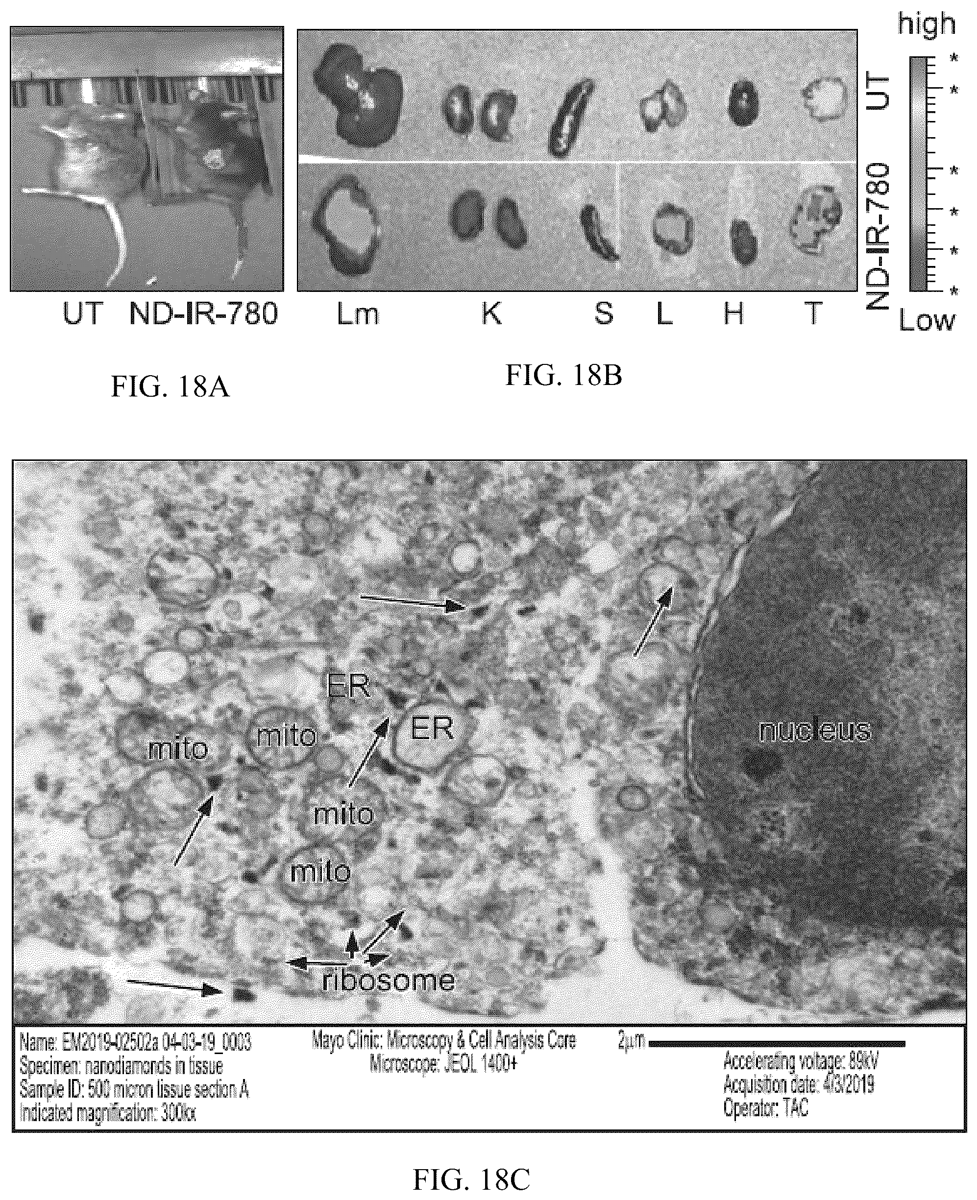 Patent US12496275 Figure 18 – Drug delivery methods and compositions