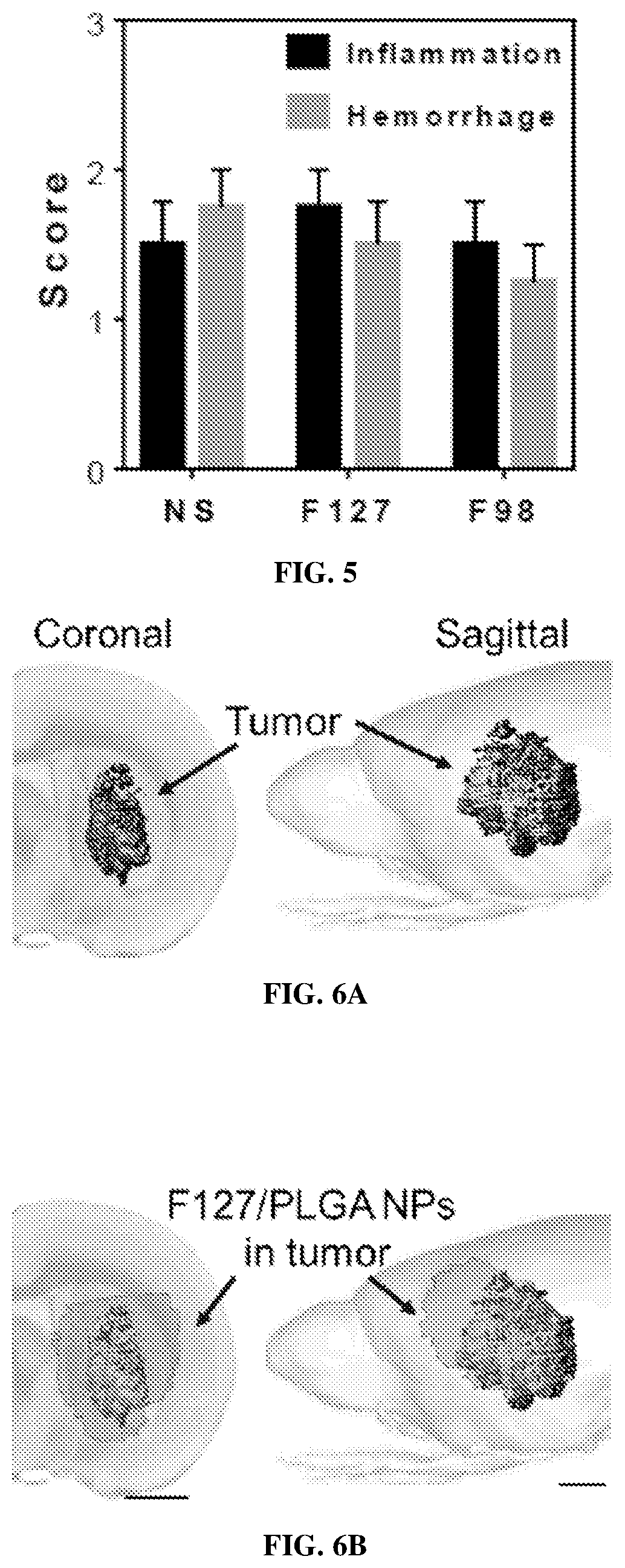 Patent US12496279 Figure 4 – Nanoparticles for drug delivery to brain