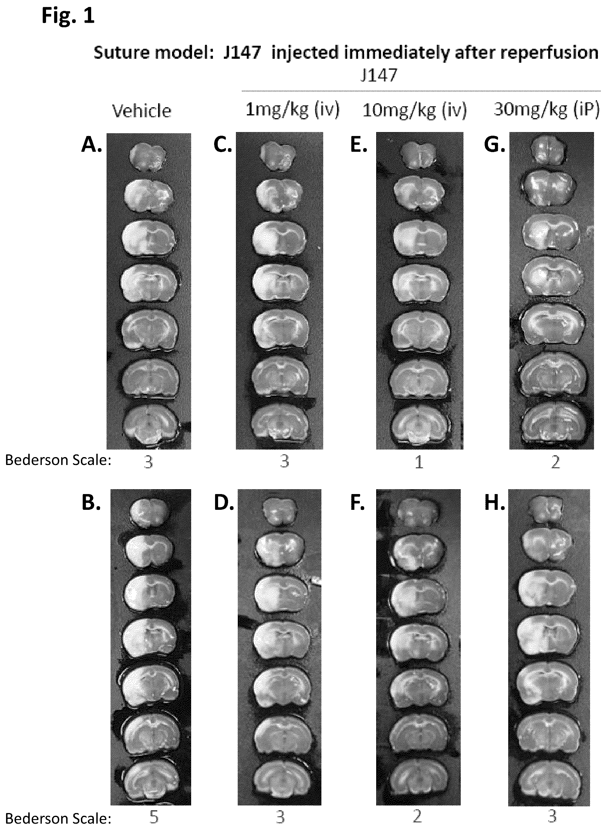 Patent US12496281 Figure 1 – Compounds for prevention and treatment of hemorrhage and vasculature instability