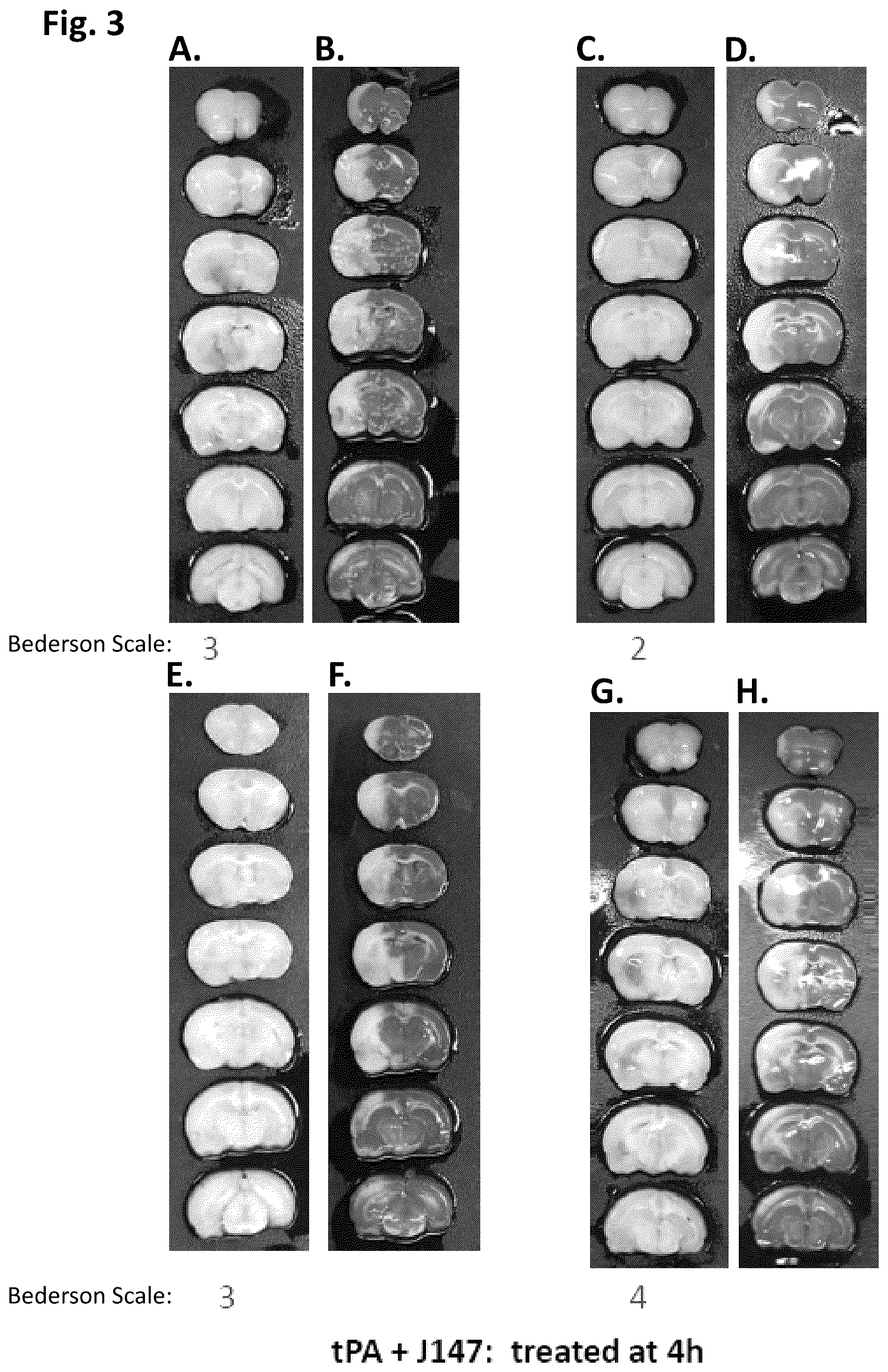 Patent US12496281 Figure 3 – Compounds for prevention and treatment of hemorrhage and vasculature instability