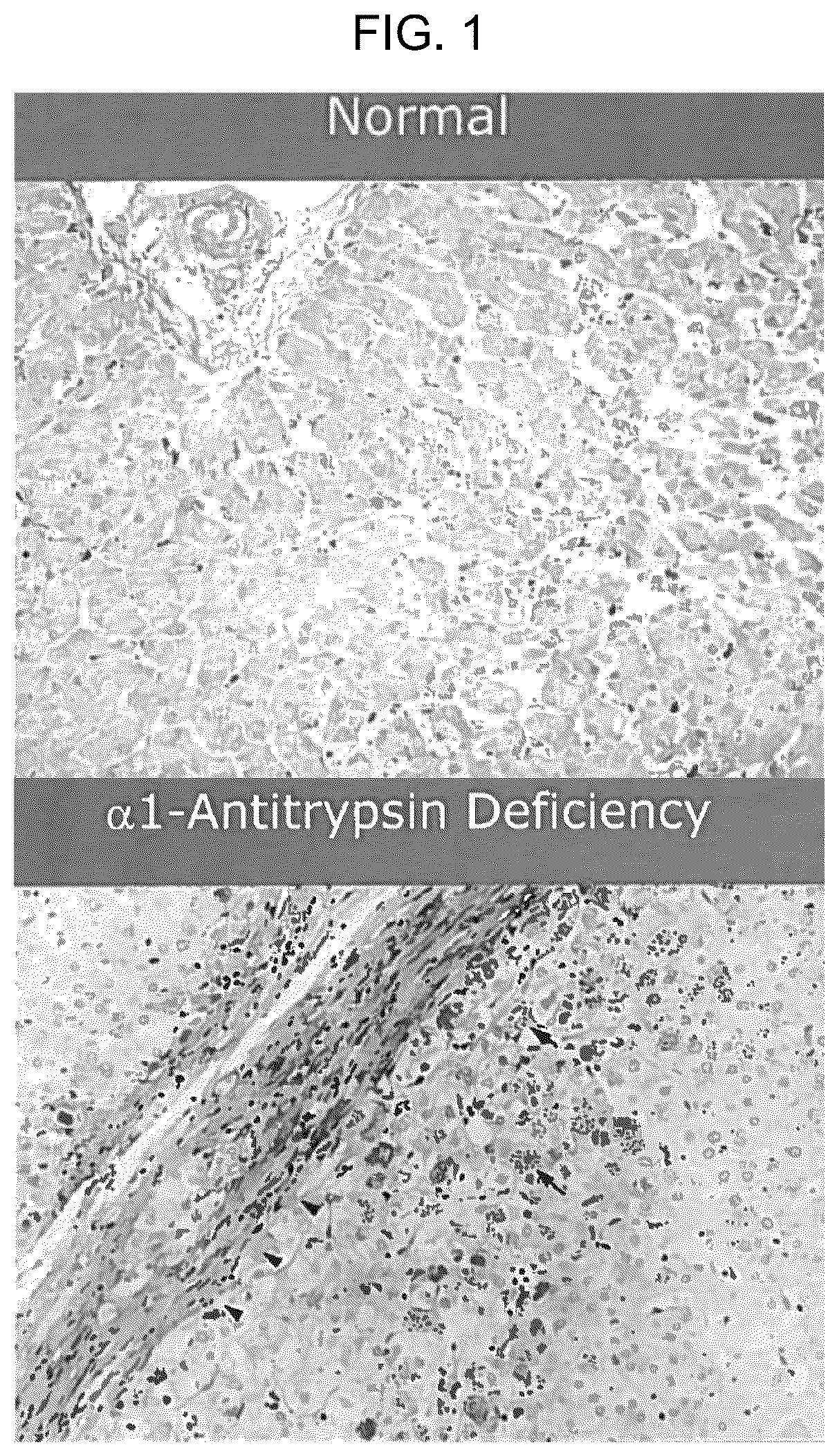 Patent US12496297 Figure 1 – Compositions of autophagy modulating agents and uses thereof