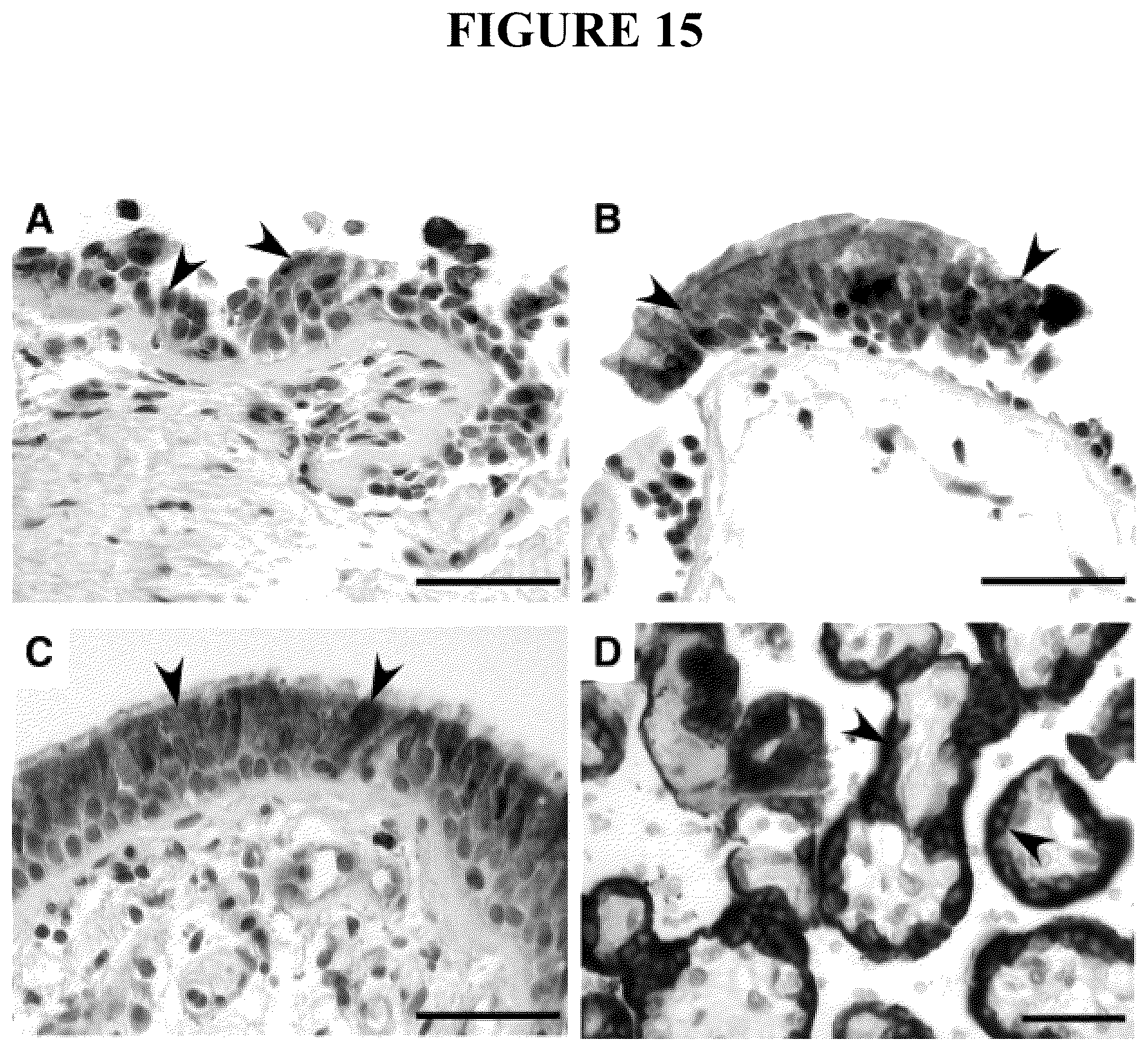 Patent US12496305 Figure 15 – Detection for determining corticosteroid responsiveness