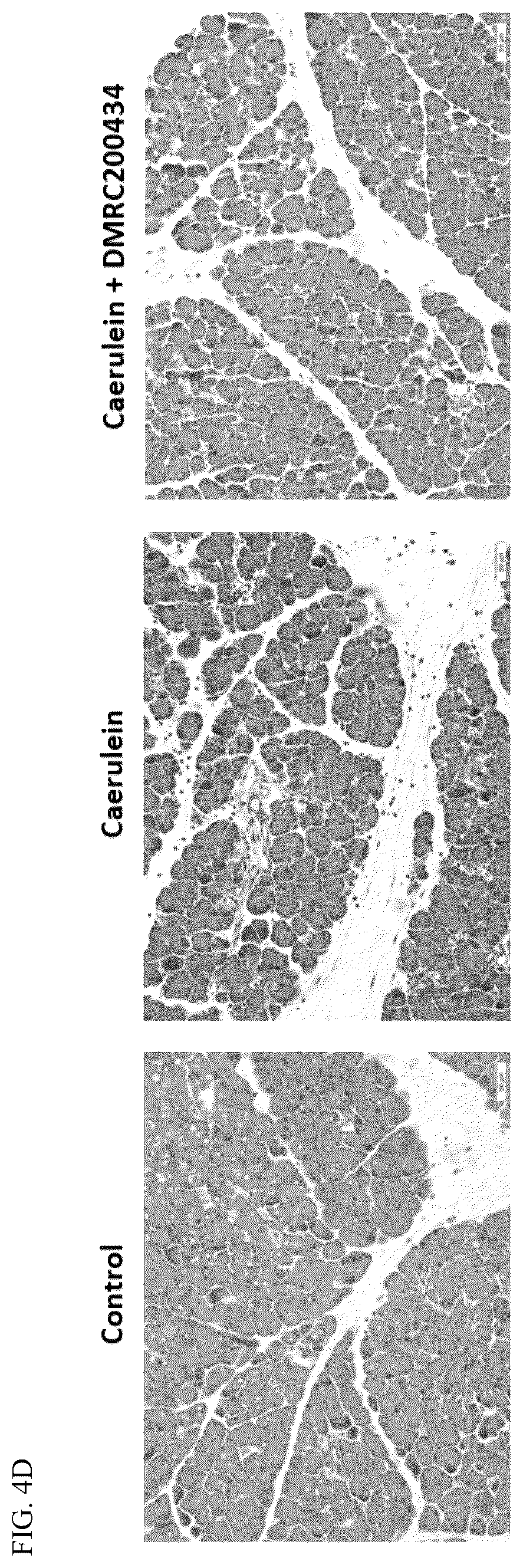Patent US12496309 Figure 6 – Method for treatment of pancreatitis