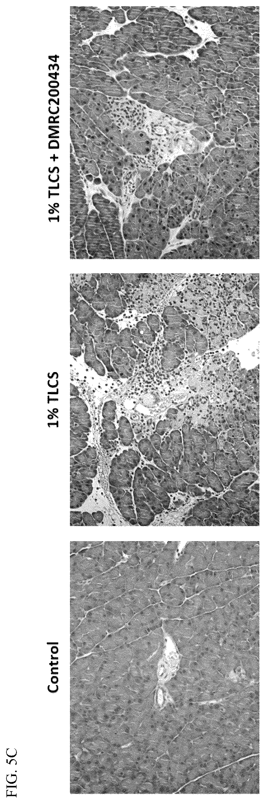 Patent US12496309 Figure 8 – Method for treatment of pancreatitis