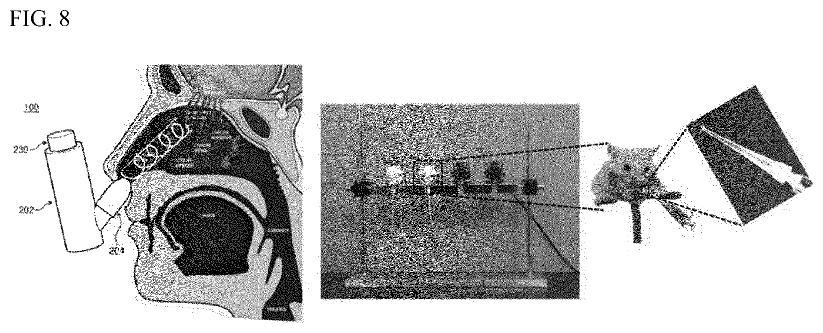 Patent US12496312 Figure 7 – Method for alleviating cancer-induced pain through control of pain signals in central nervous system