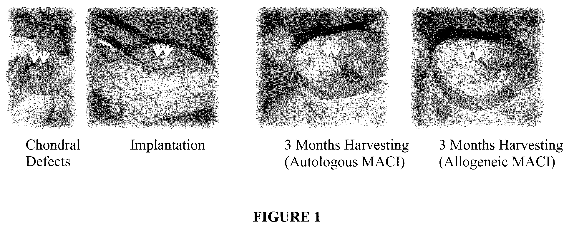 Patent US12496317 Figure 1 – Compositions and methods for repairing cartilage defects