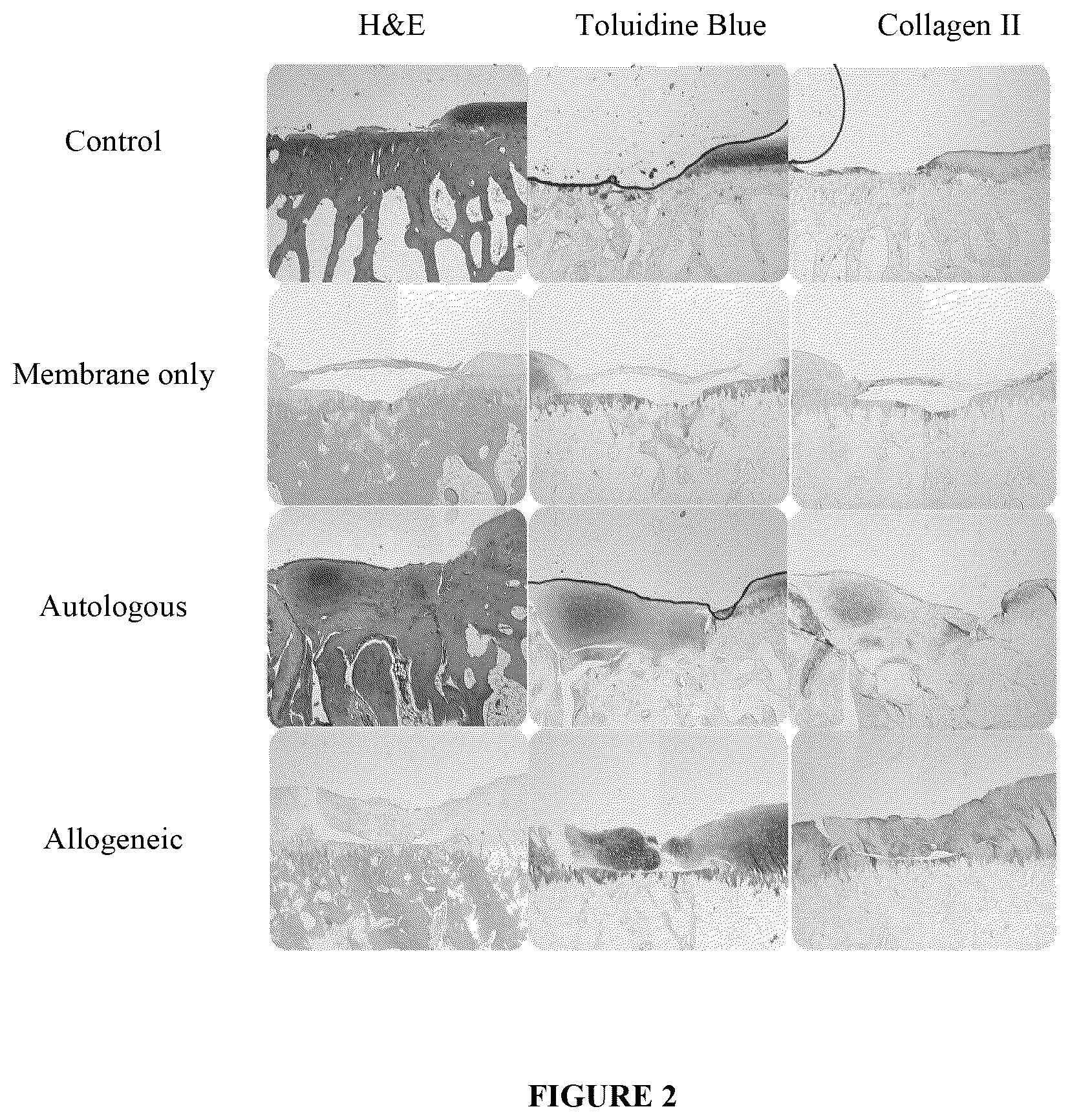 Patent US12496317 Figure 2 – Compositions and methods for repairing cartilage defects