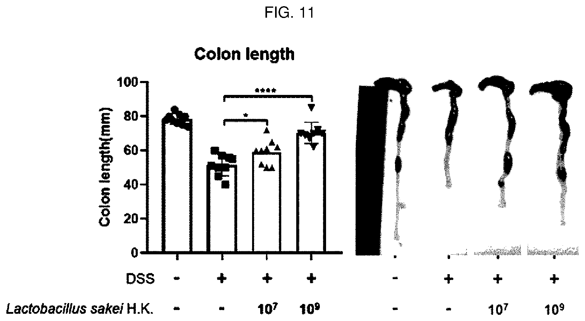 Patent US12496319 Figure 11 – Inflammatory diseases, comprising Lactobacillus sakei CVL-001 strain