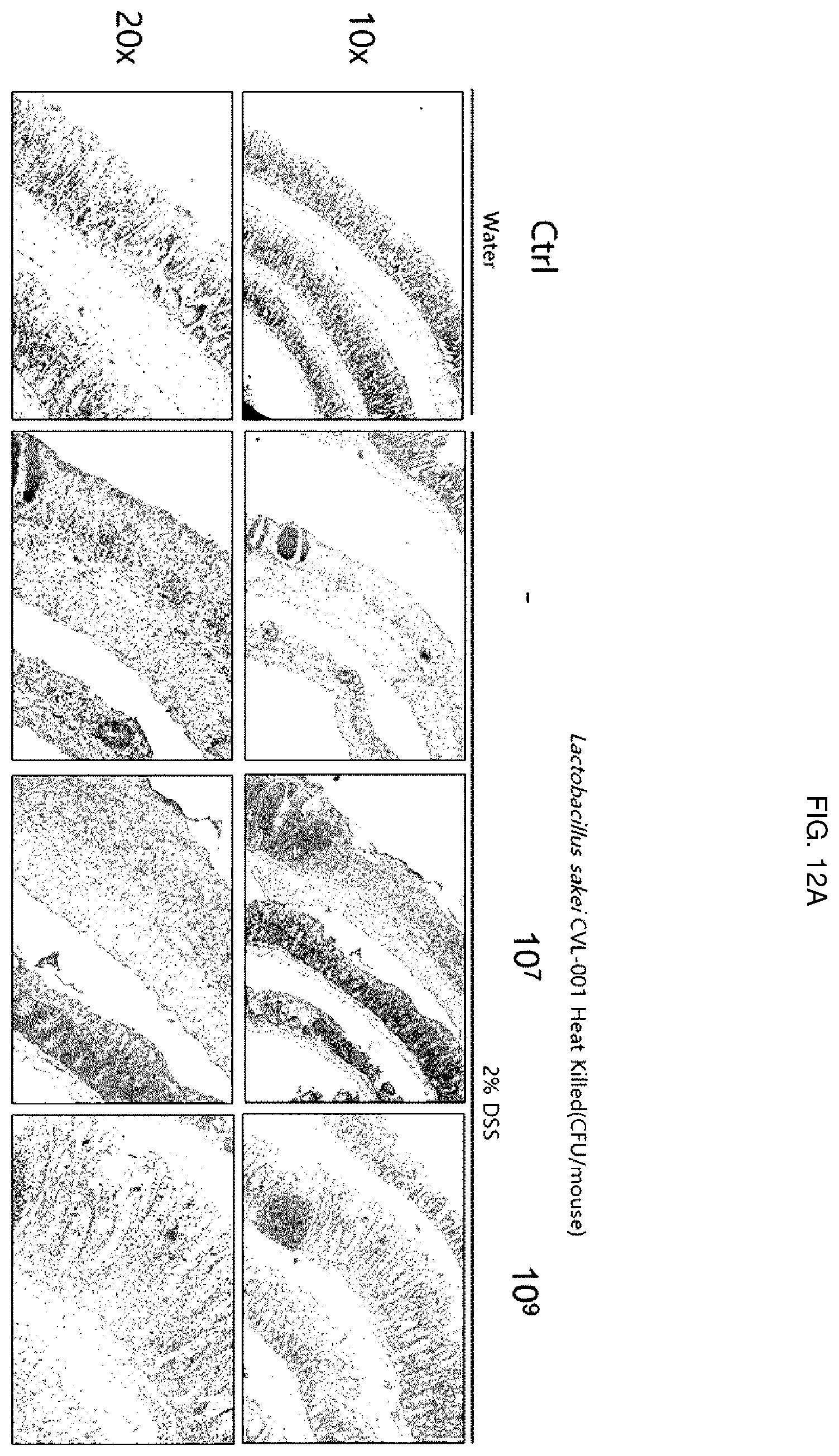 Patent US12496319 Figure 12 – Inflammatory diseases, comprising Lactobacillus sakei CVL-001 strain