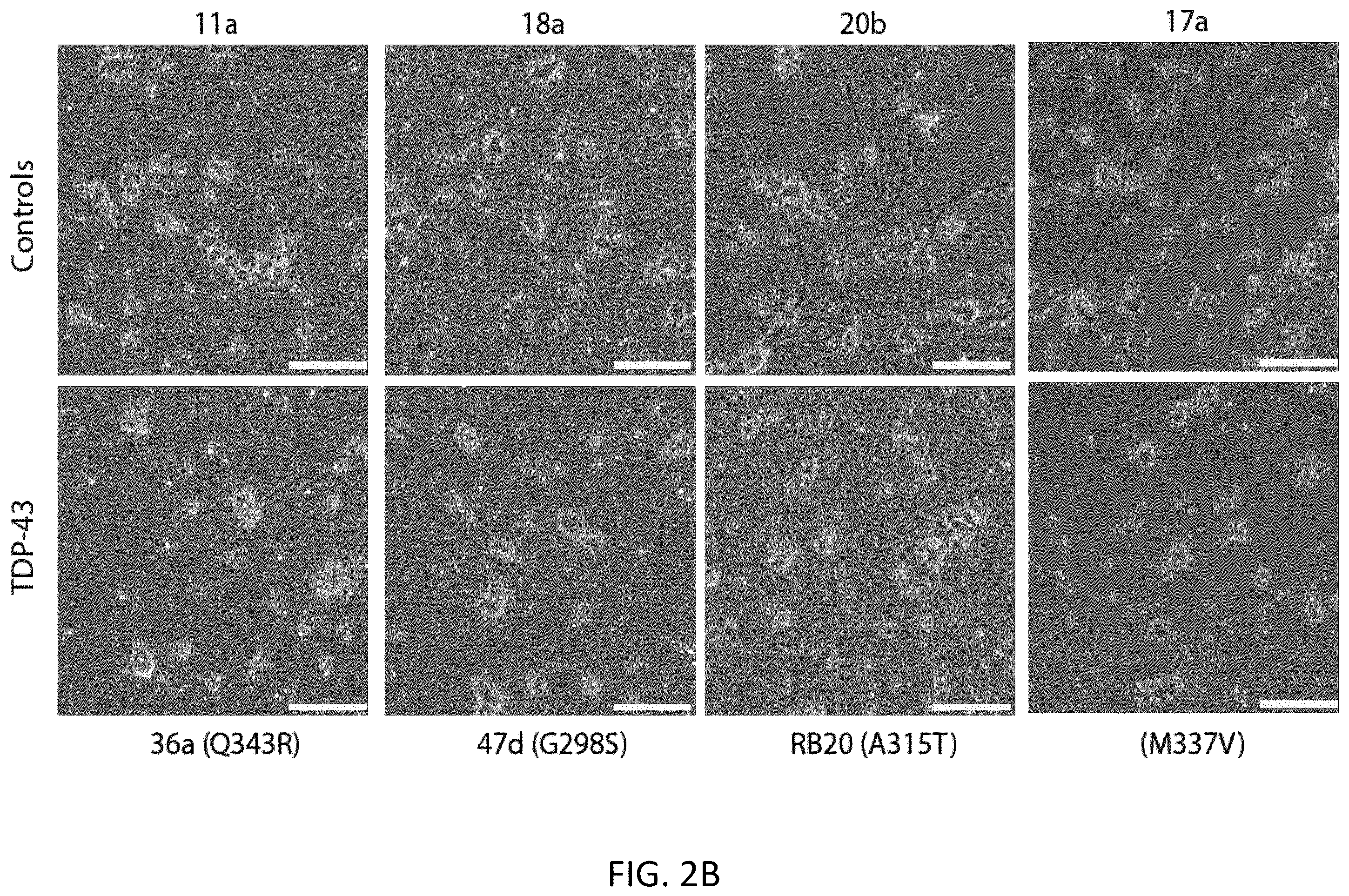 Patent US12496327 Figure 6 – Methods and compositions for restoring STMN2 levels