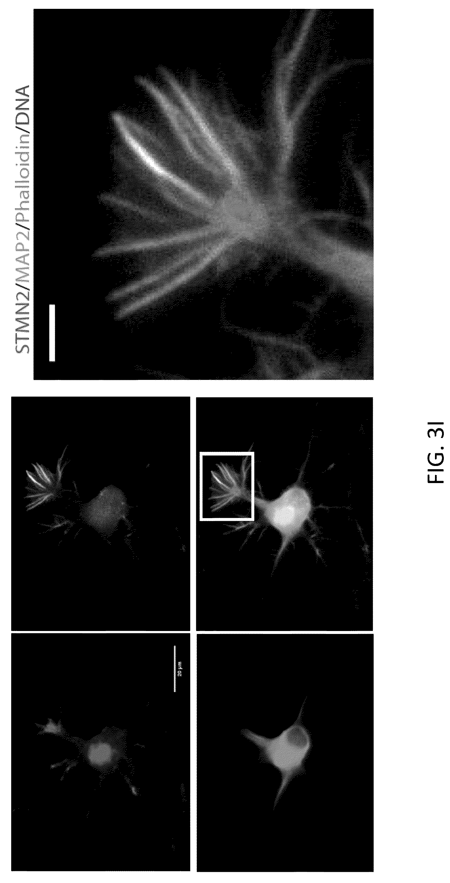 Patent US12496327 Figure 15 – Methods and compositions for restoring STMN2 levels