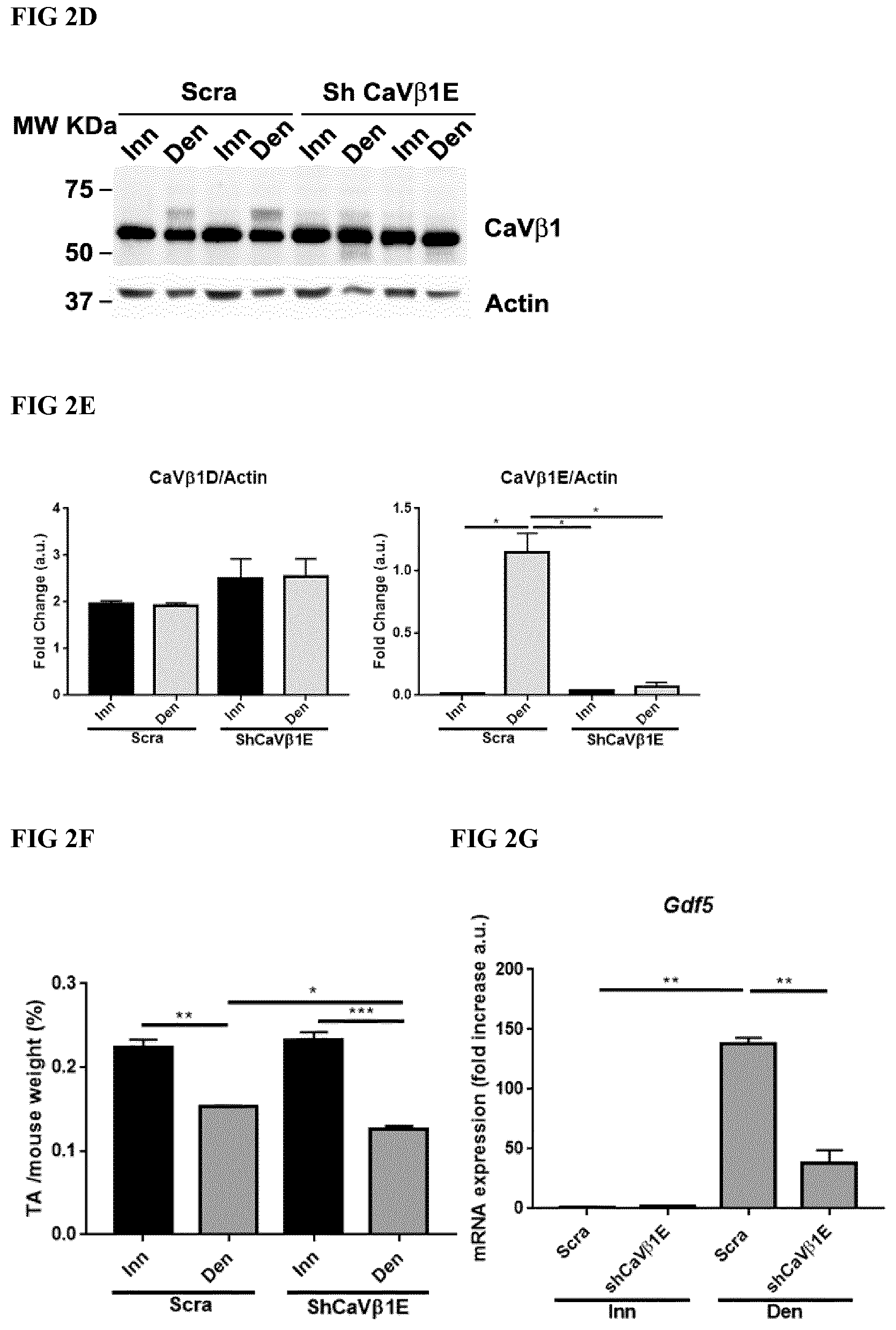 Patent US12496328 Figure 4 – Compositions for the treatment of sarcopenia or disuse atrophy