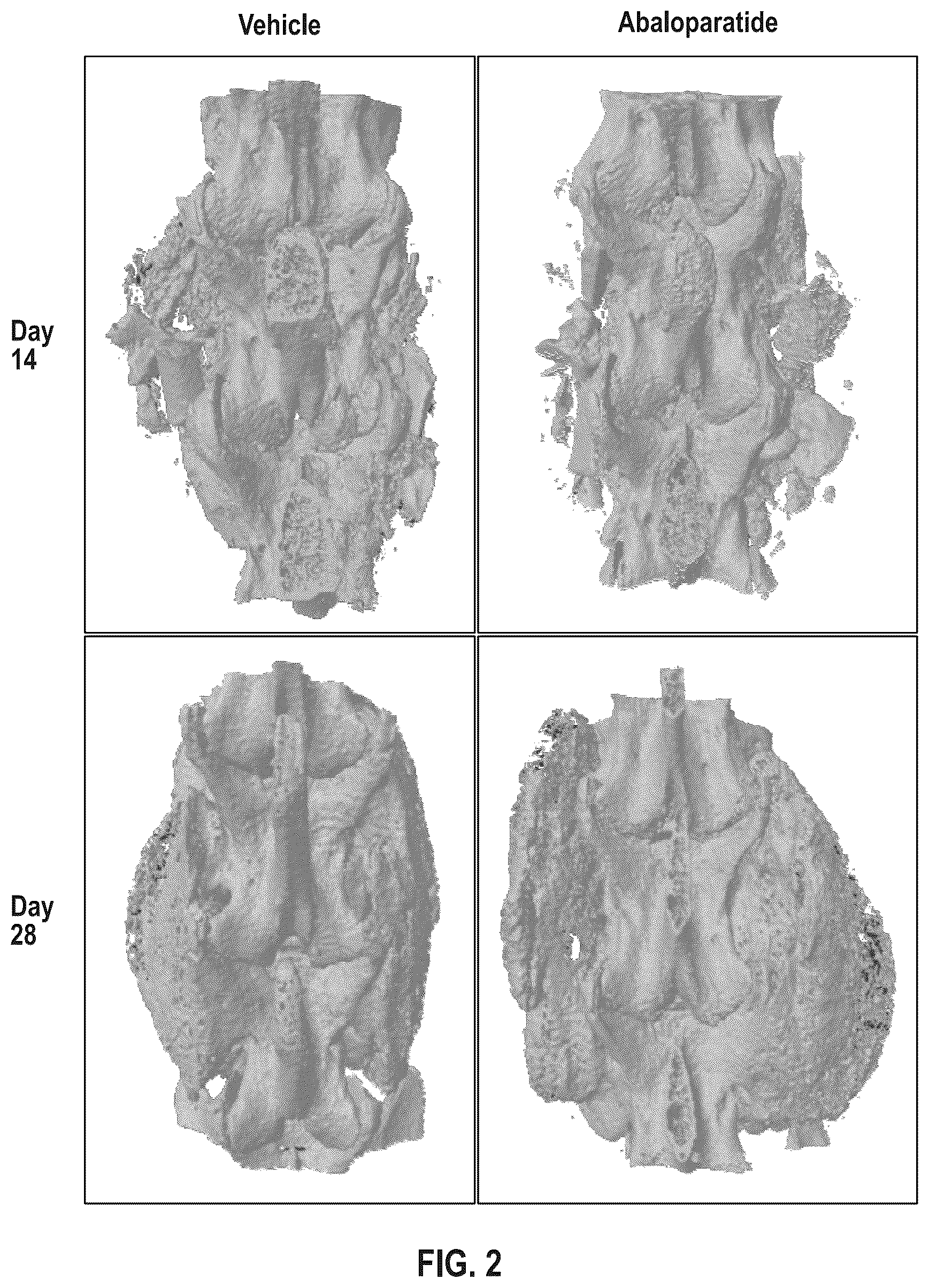 Patent US12496330 Figure 2 – Methods of improving spinal fusion with abaloparatide