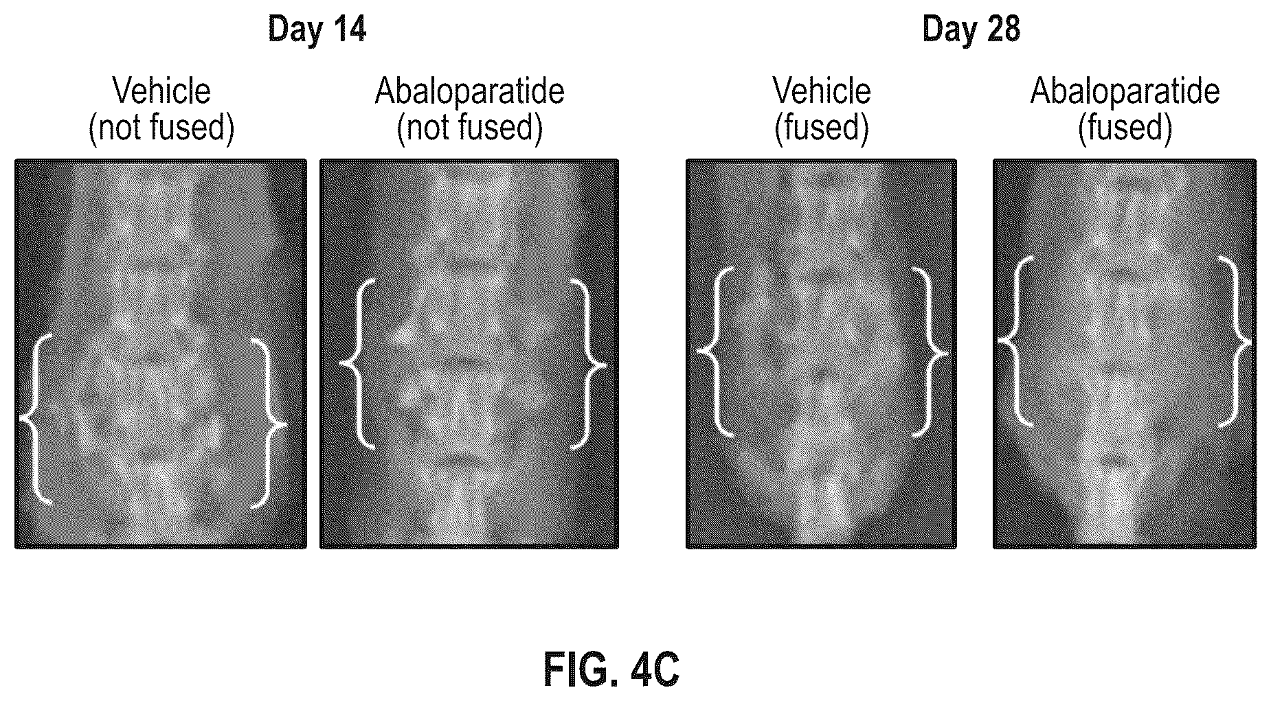 Patent US12496330 Figure 5 – Methods of improving spinal fusion with abaloparatide