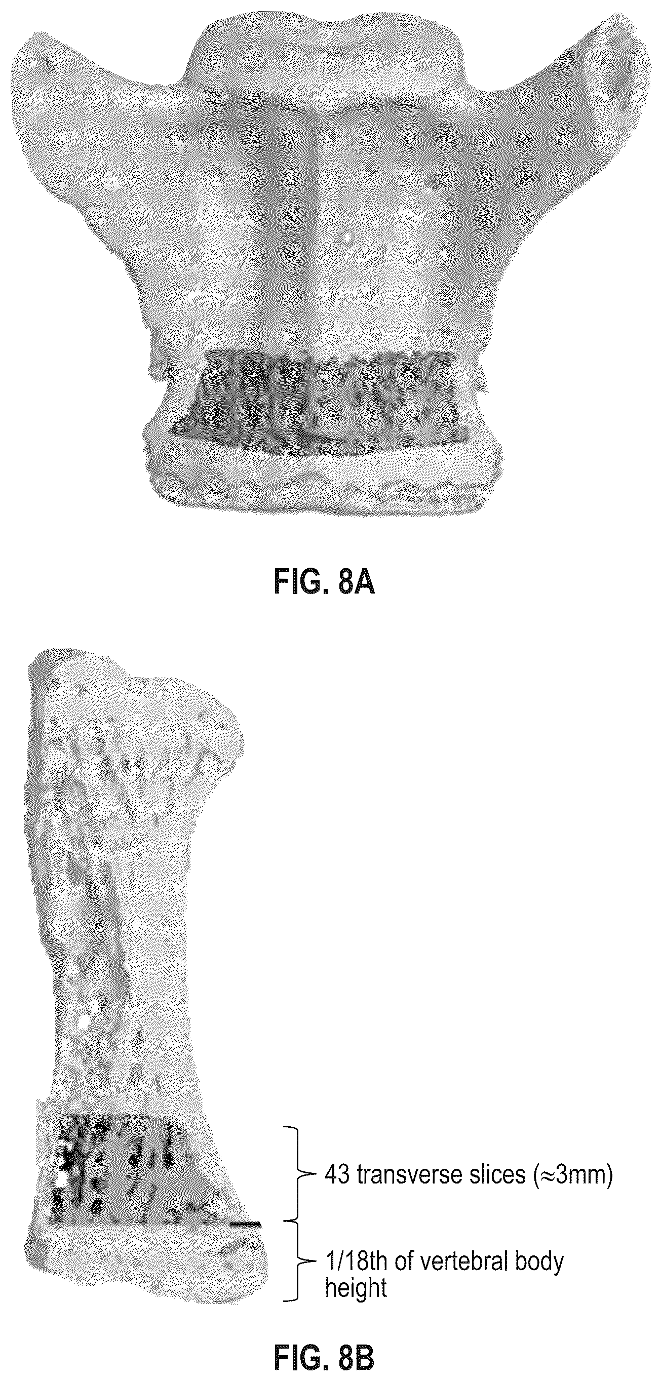 Patent US12496330 Figure 10 – Methods of improving spinal fusion with abaloparatide