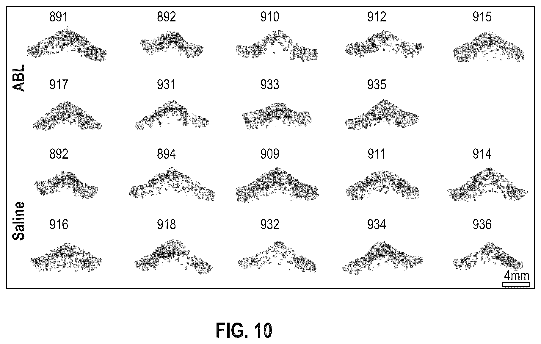 Patent US12496330 Figure 12 – Methods of improving spinal fusion with abaloparatide