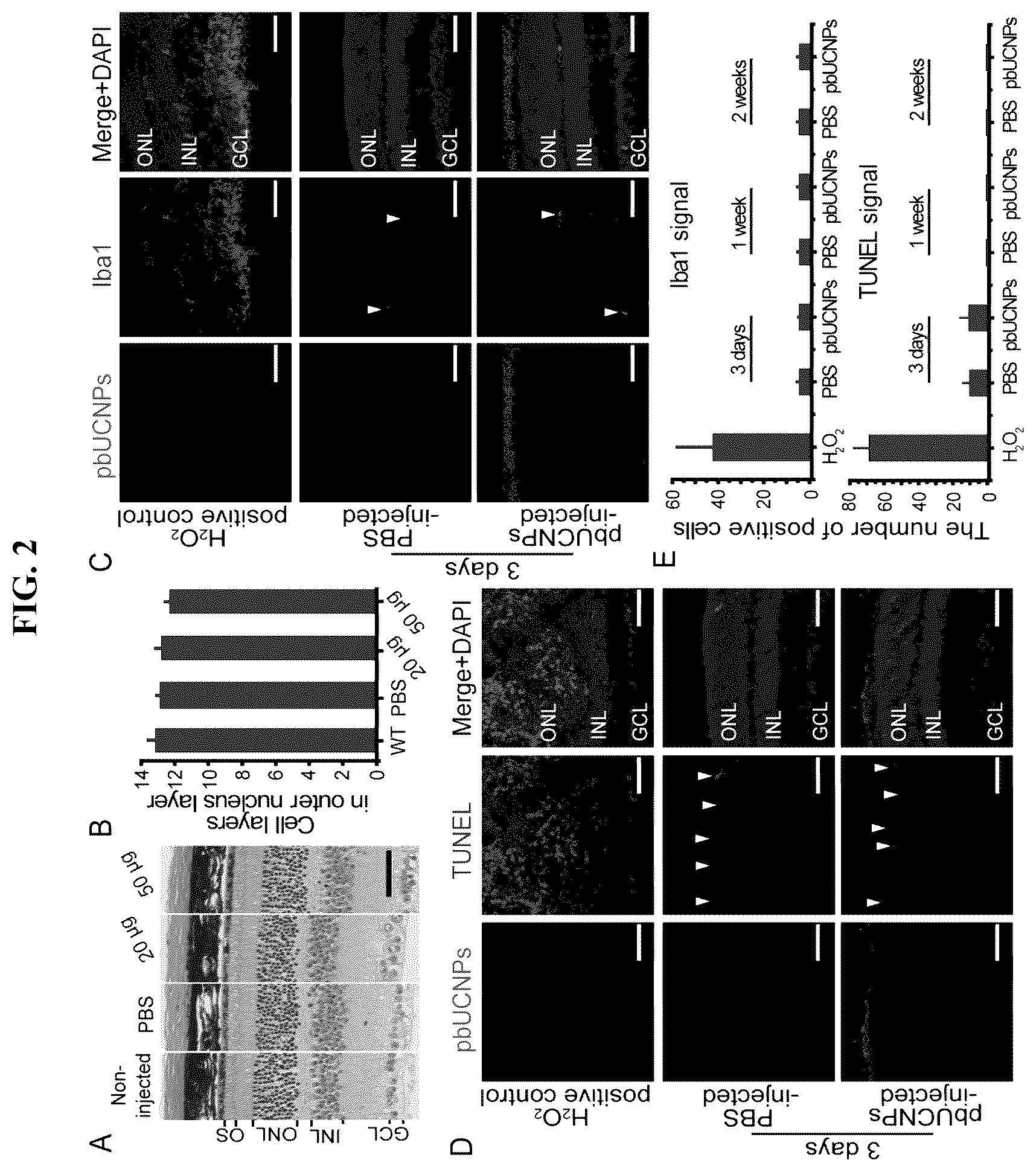 Patent US12496343 Figure 2 – Long-acting photoreceptor-binding nanoparticles, and compositions and methods thereof
