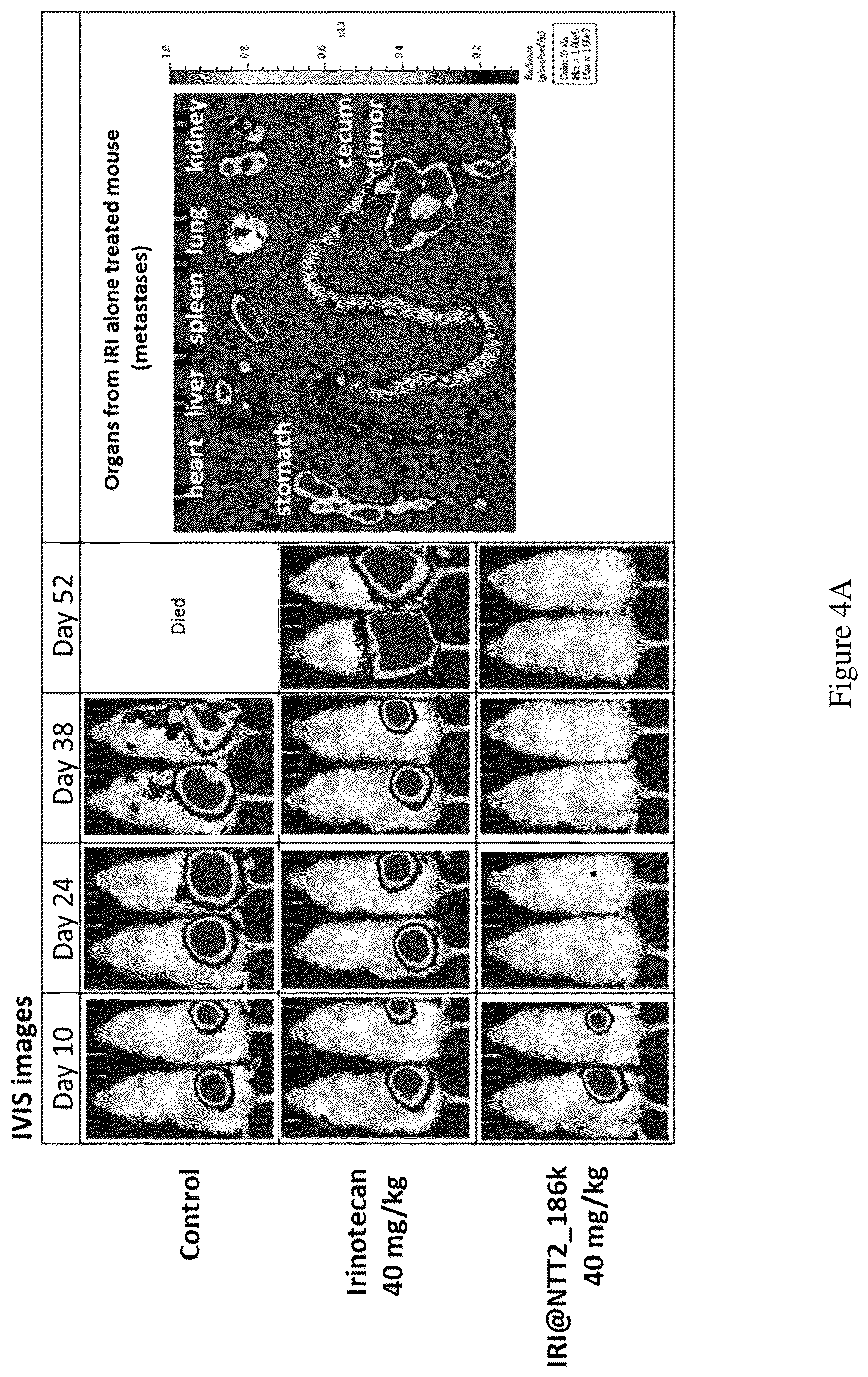 Patent US12496355 Figure 4 – Method for treating a cancer and/or cancer metastasis