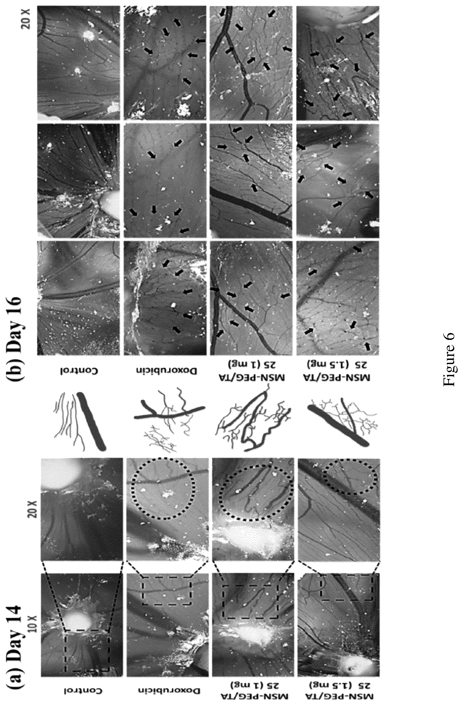 Patent US12496355 Figure 7 – Method for treating a cancer and/or cancer metastasis