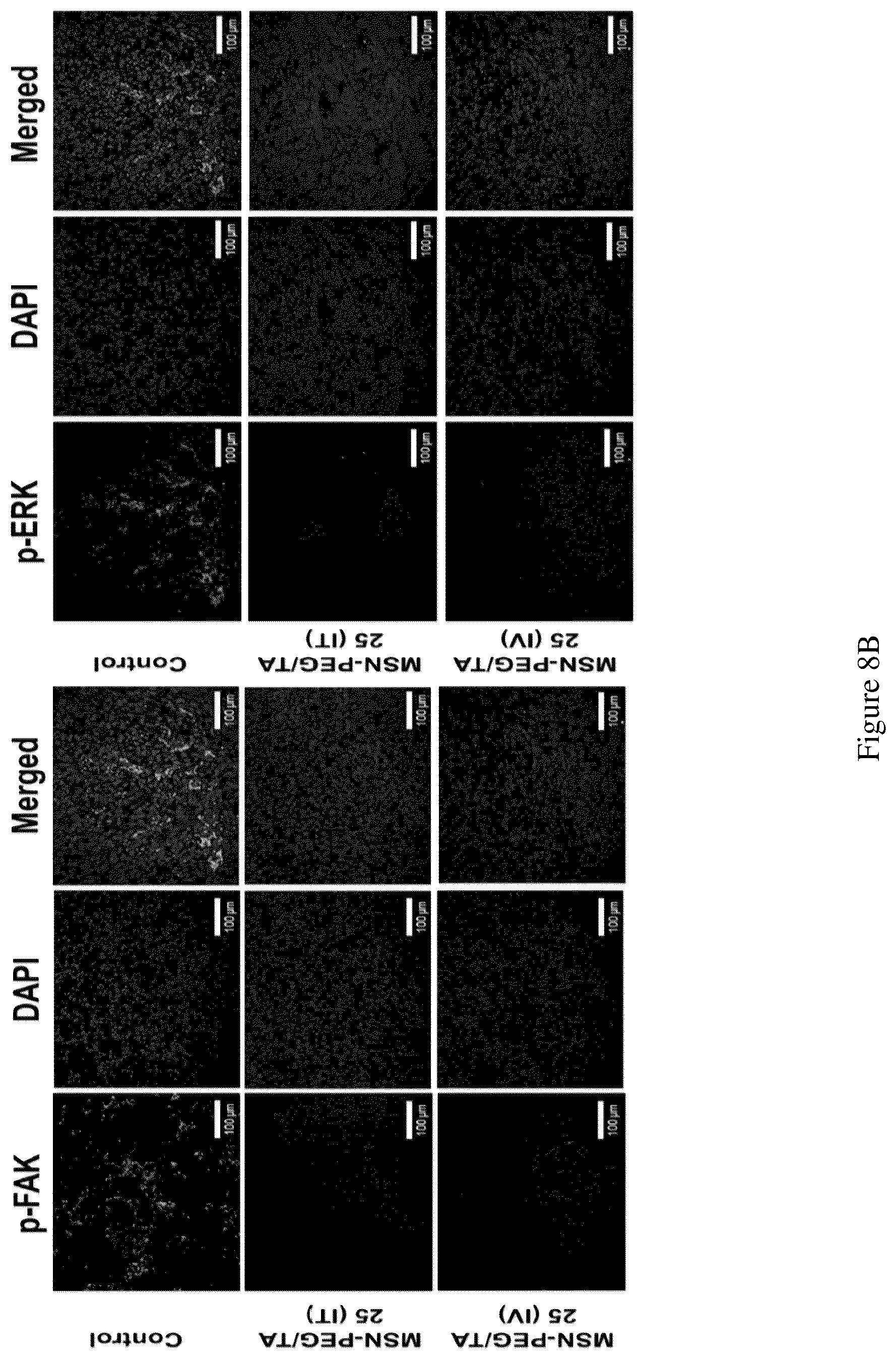 Patent US12496355 Figure 10 – Method for treating a cancer and/or cancer metastasis