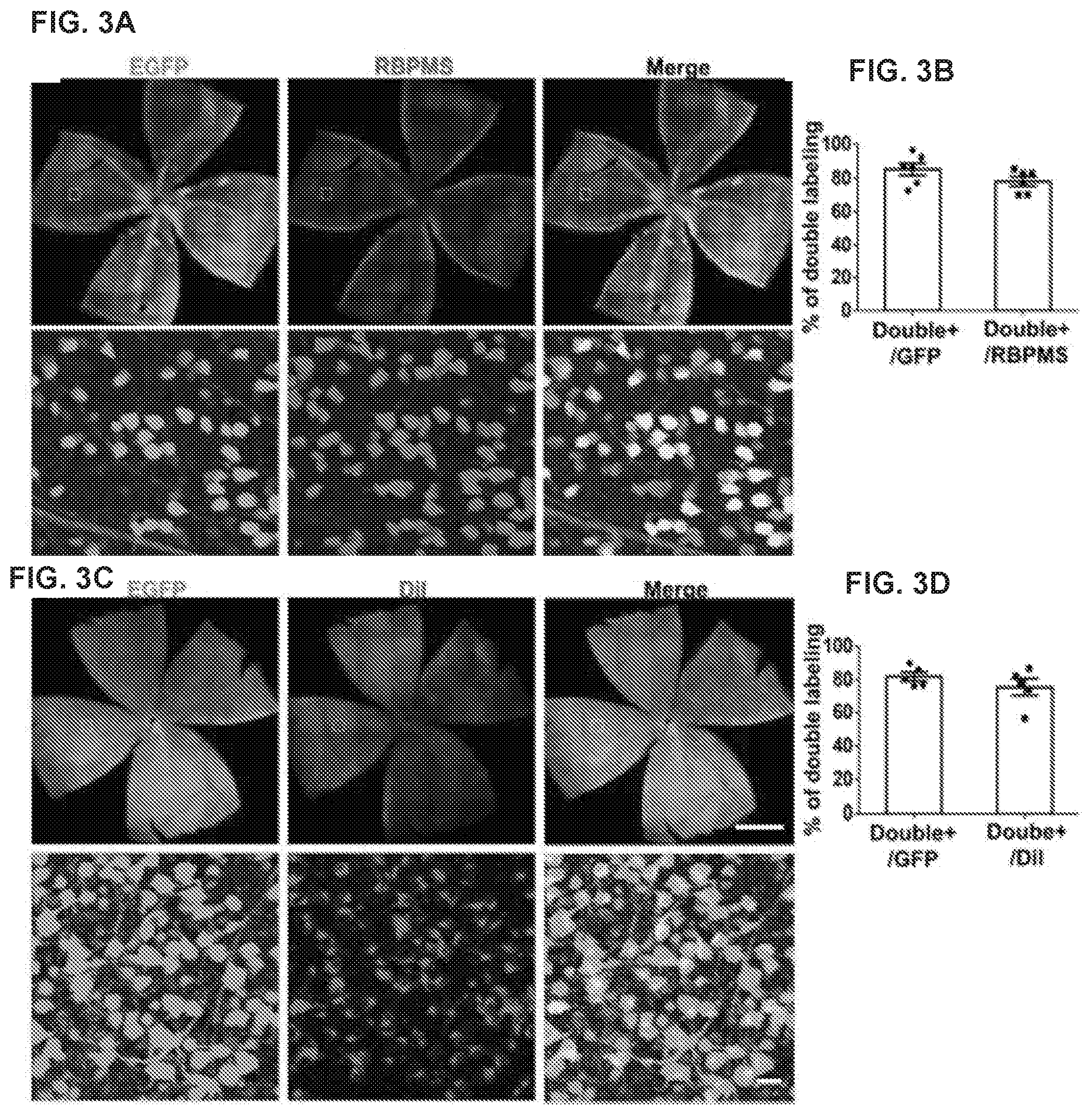 Patent US12496356 Figure 3 – Neuroprotection of neuronal soma and axon by modulating ER stress/UPR molecules