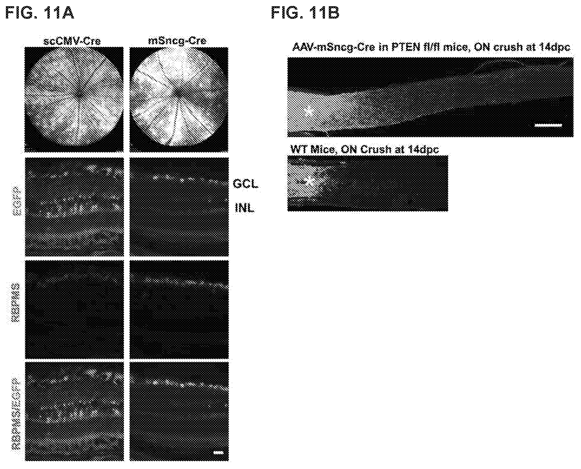 Patent US12496356 Figure 11 – Neuroprotection of neuronal soma and axon by modulating ER stress/UPR molecules