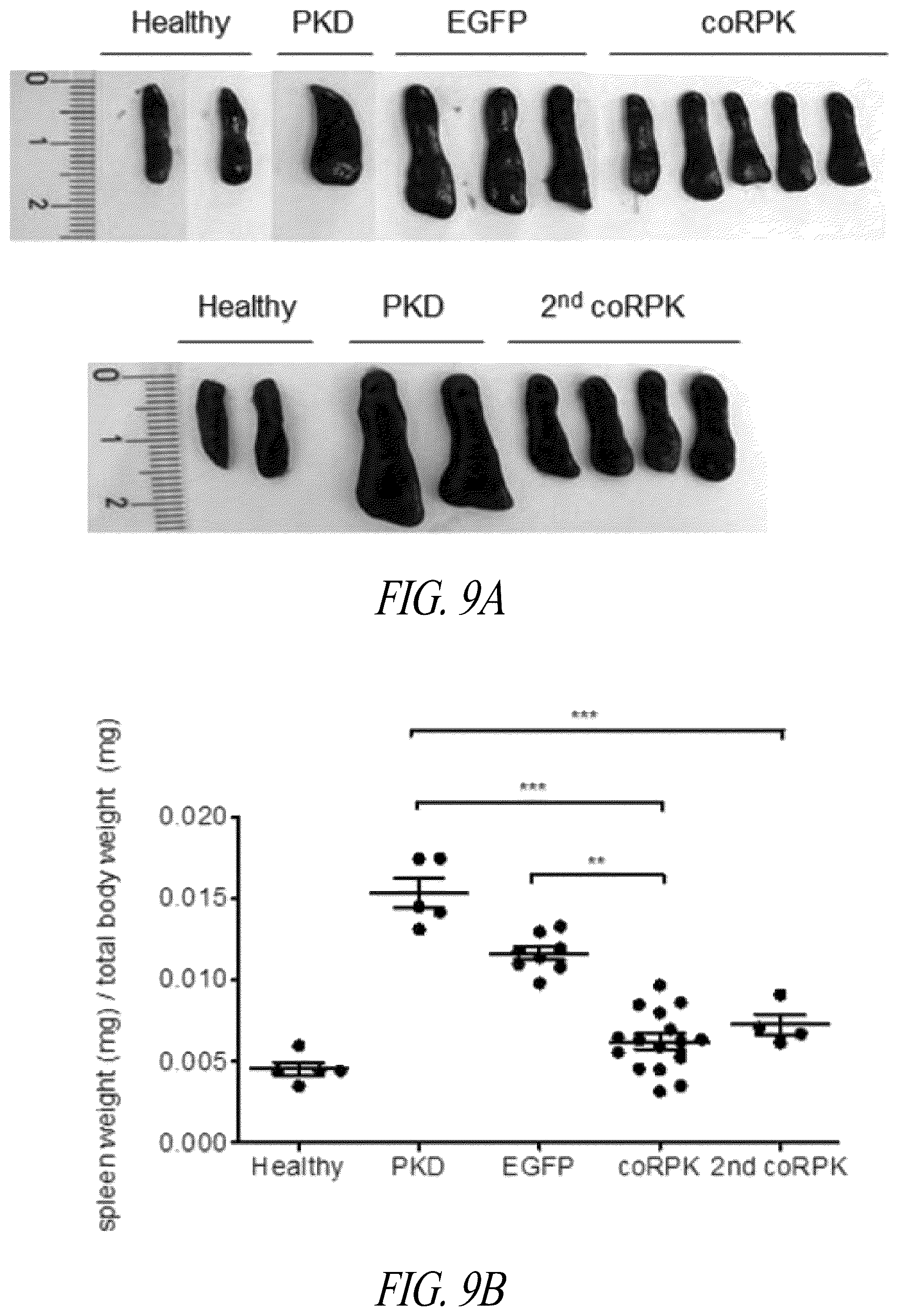 Patent US12496359 Figure 17 – Lentiviral vectors for delivery of PKLR to treat Pyruvate Kinase Deficiency