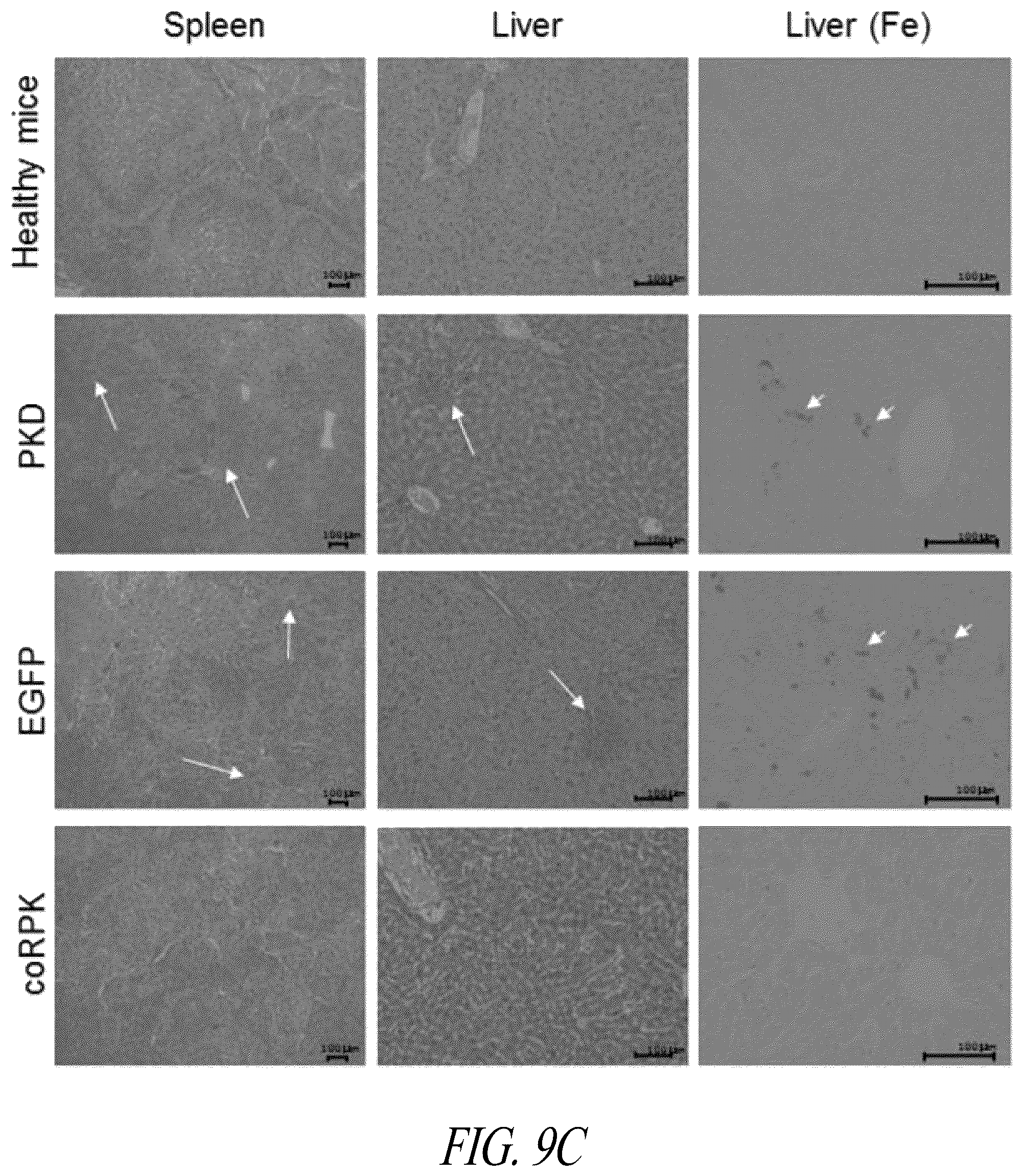 Patent US12496359 Figure 18 – Lentiviral vectors for delivery of PKLR to treat Pyruvate Kinase Deficiency