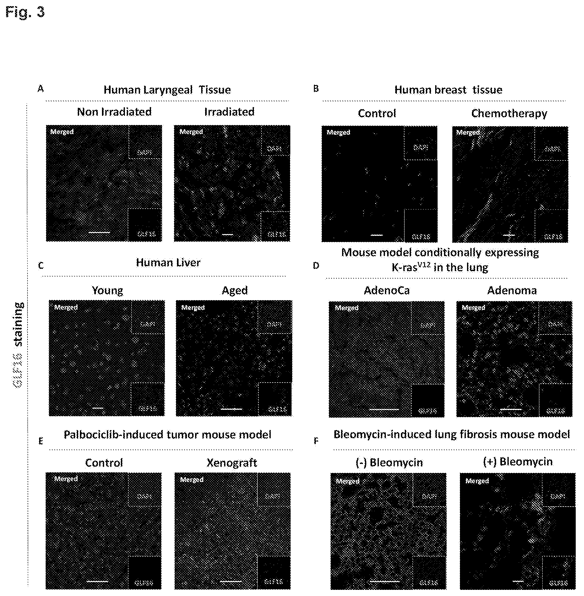 Patent US12496361 Figure 4 – Imaging compounds for detecting or imaging senescent cells