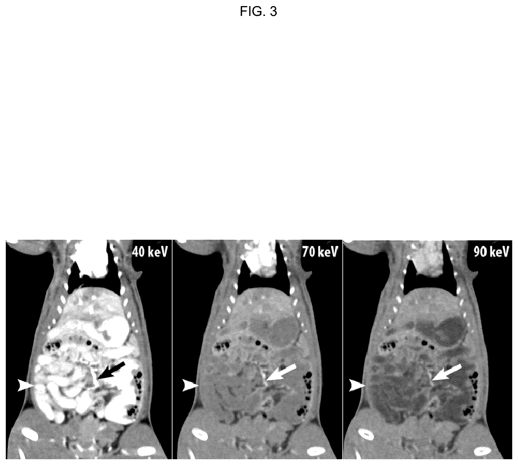 Patent US12496362 Figure 3 – Silicone-based enteric CT contrast material