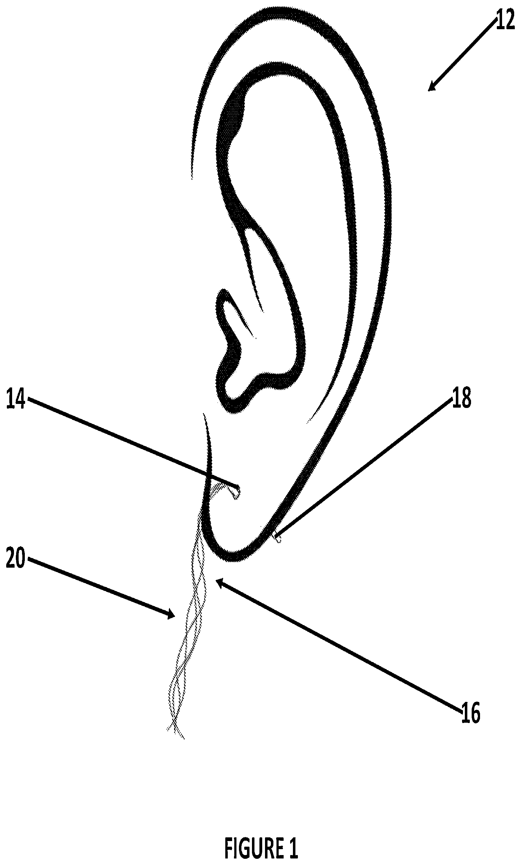 Patent US12496364 Figure 1 – Pierced body part hole cleaning kit and method for cleaning