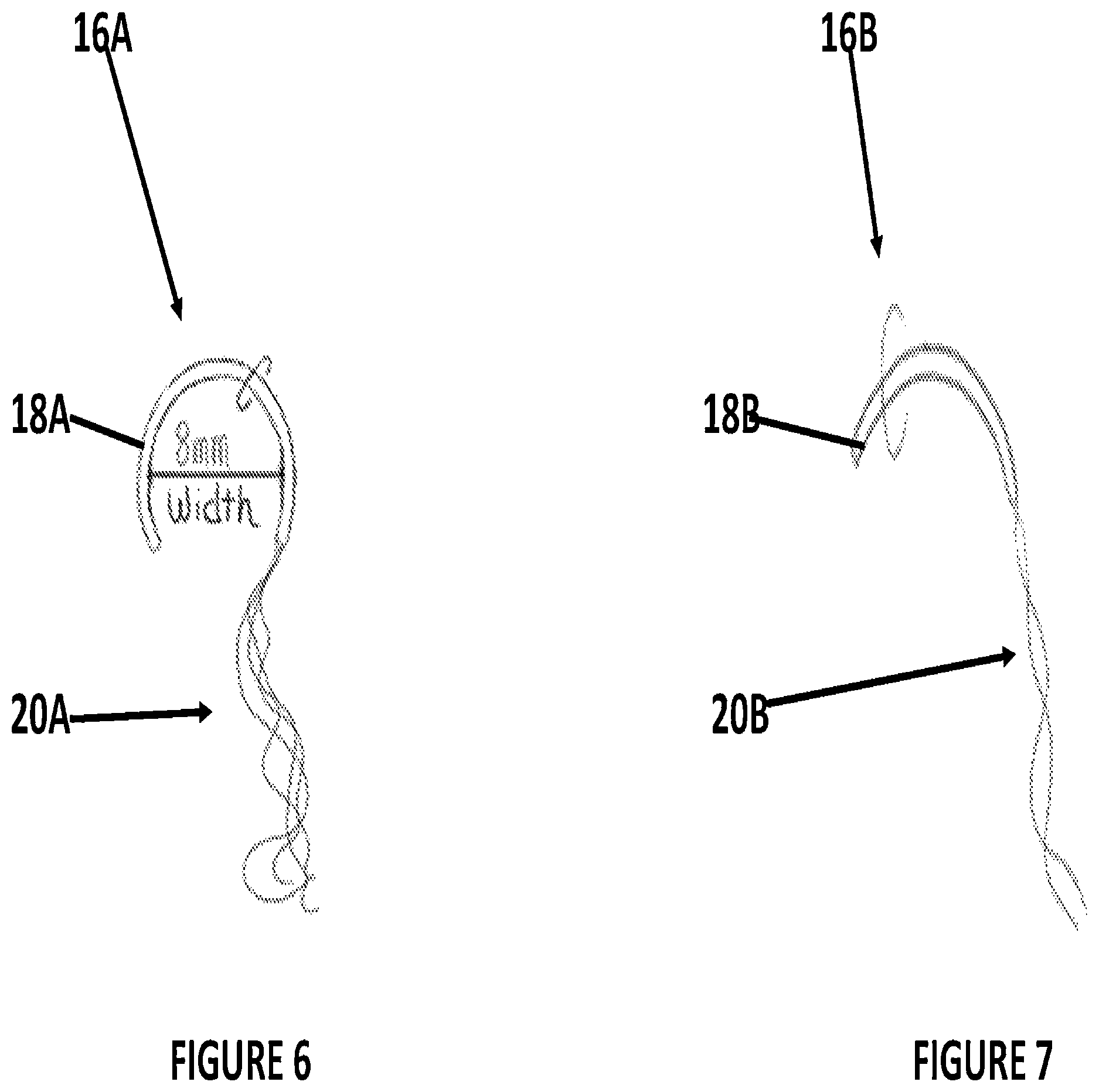 Patent US12496364 Figure 6 – Pierced body part hole cleaning kit and method for cleaning