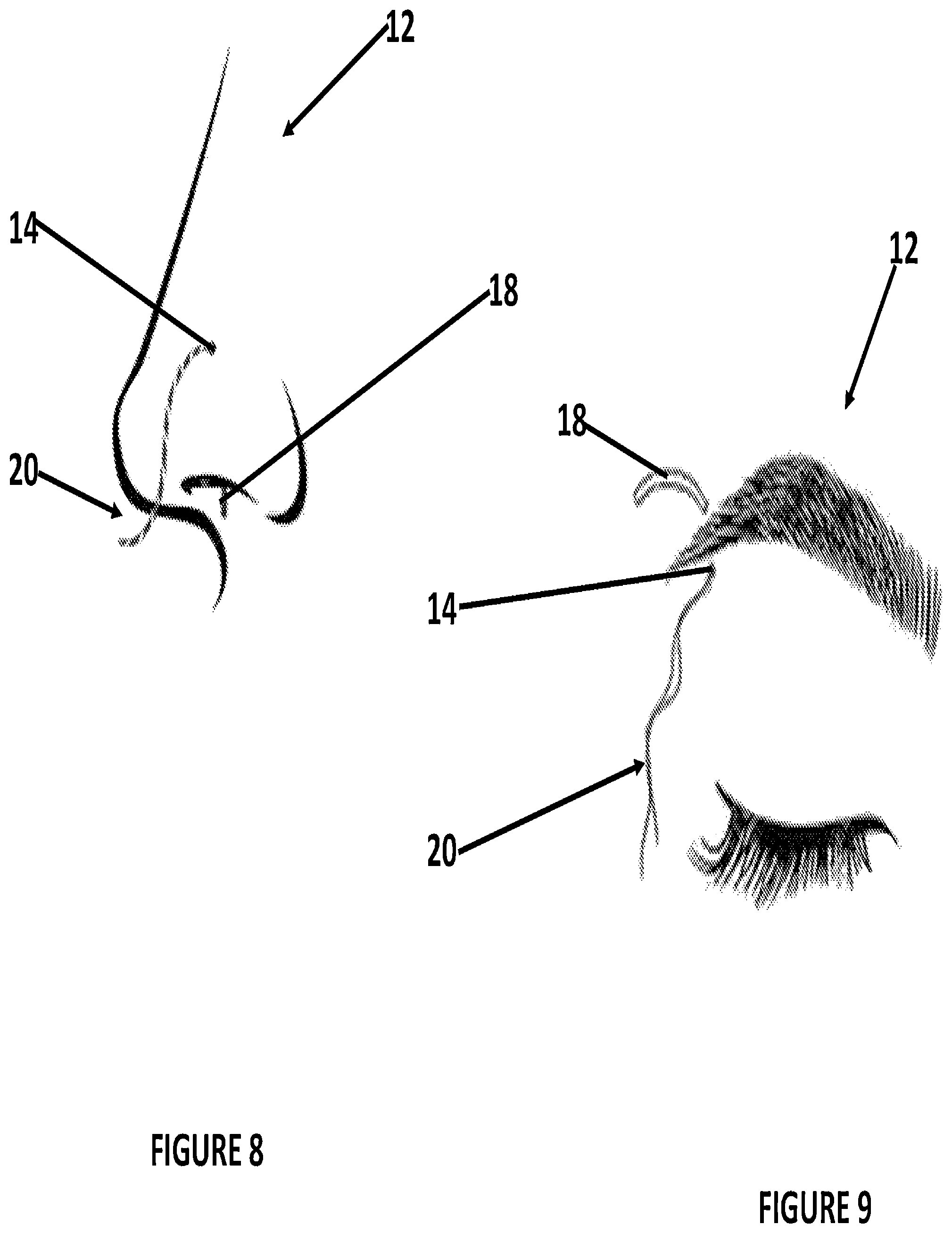 Patent US12496364 Figure 7 – Pierced body part hole cleaning kit and method for cleaning