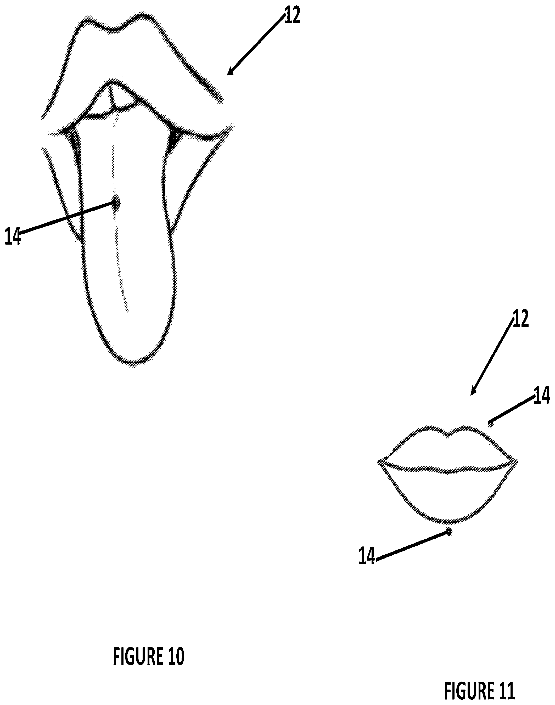 Patent US12496364 Figure 8 – Pierced body part hole cleaning kit and method for cleaning