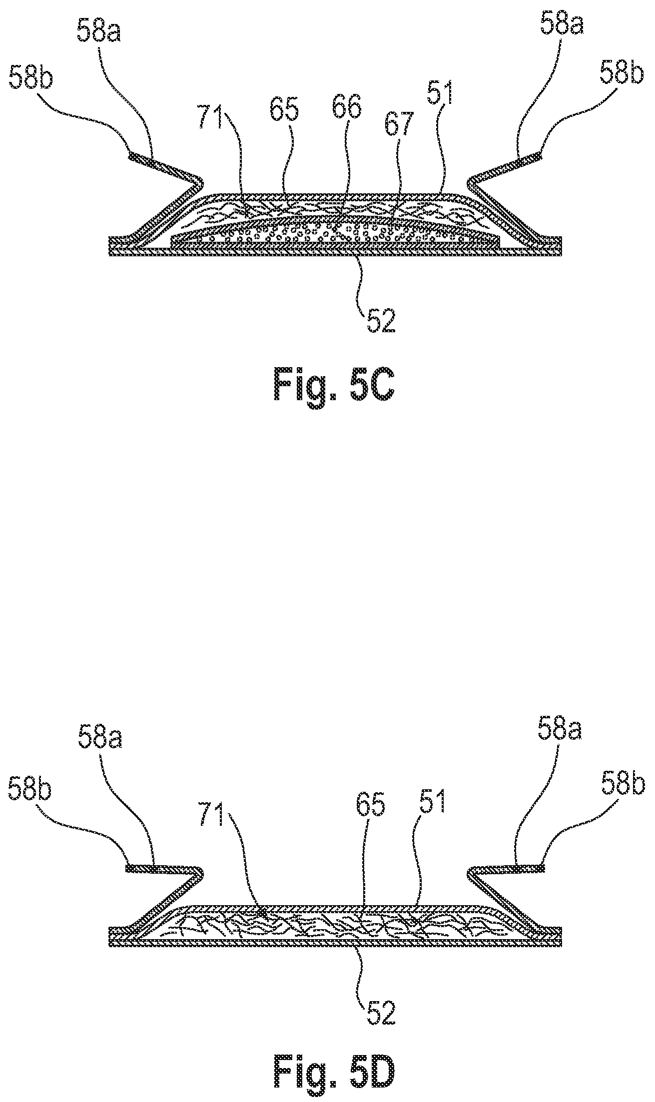 Patent US12496373 Figure 5 – Process of enzymatic degradation of an absorbent structure for a hygiene article