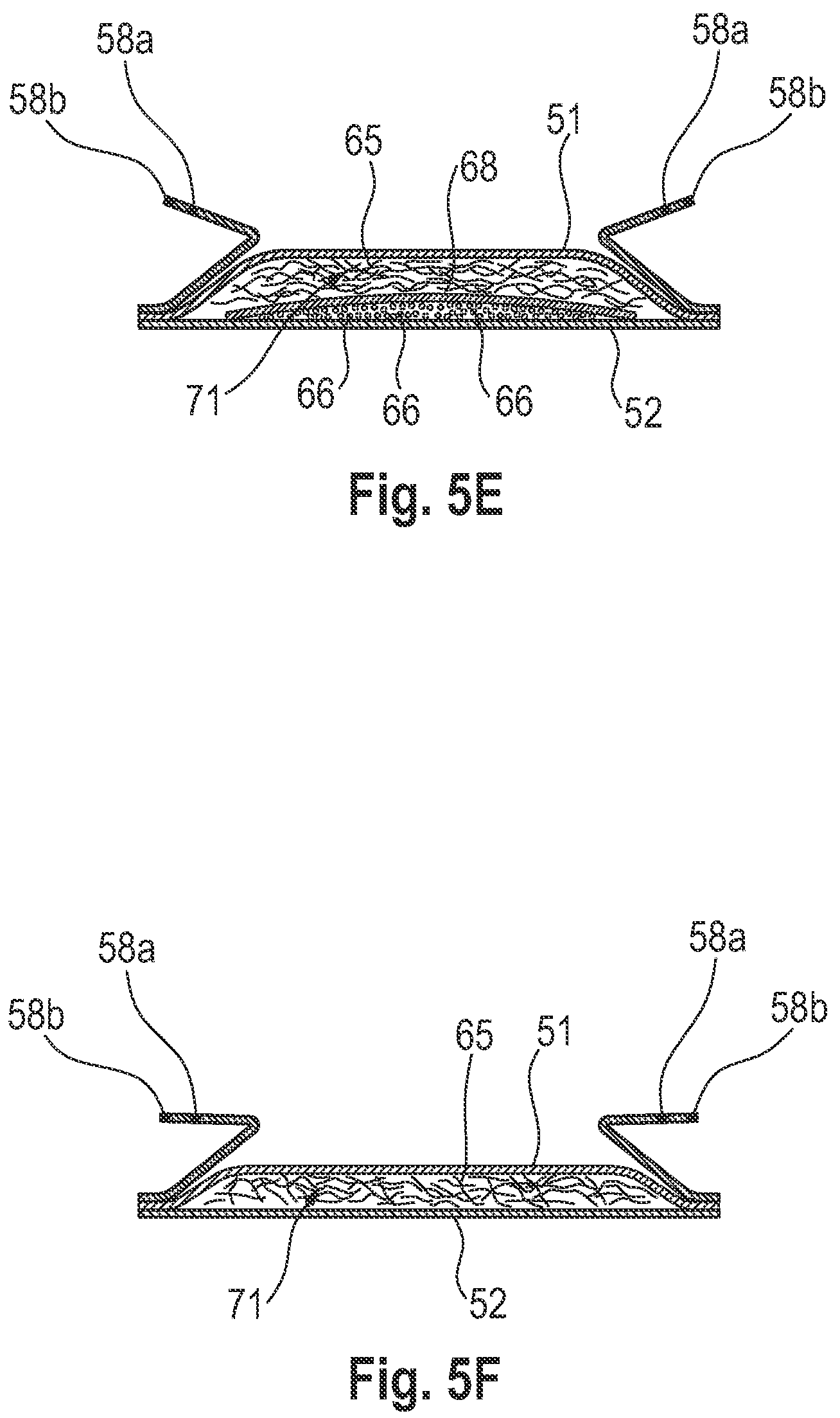 Patent US12496373 Figure 6 – Process of enzymatic degradation of an absorbent structure for a hygiene article