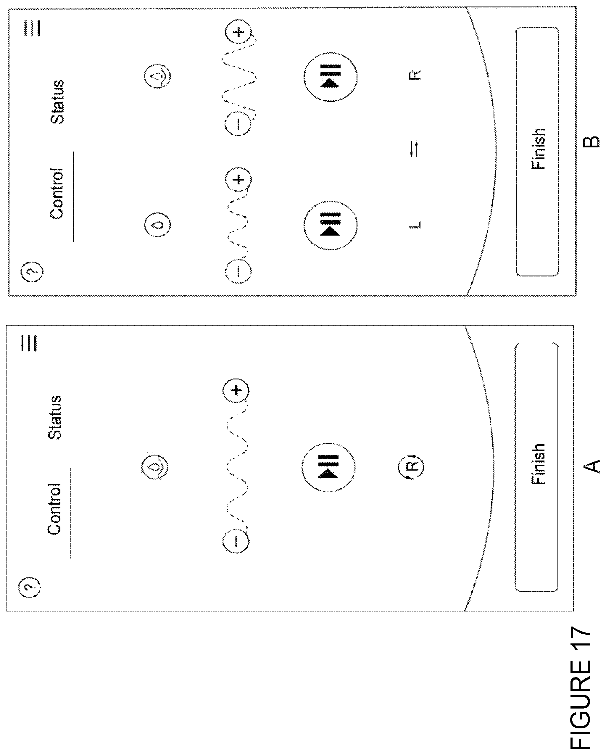 Patent US12496381 Figure 17 – Breast pump system