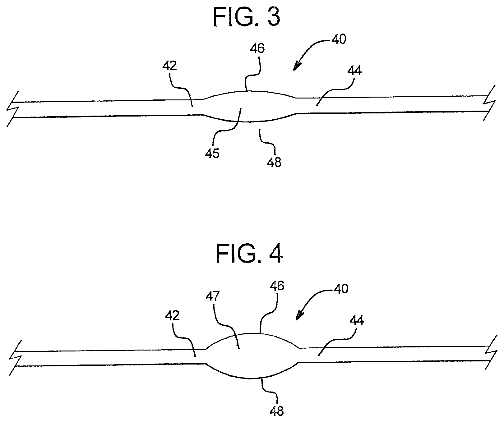 Patent US12496383 Figure 3 – Flow regulation device