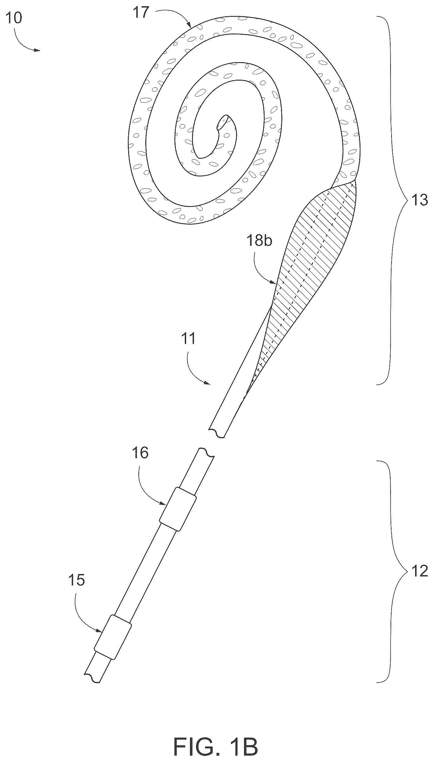 Patent US12496385 Figure 2 – Peritoneal dialysis catheter with an expandable structure