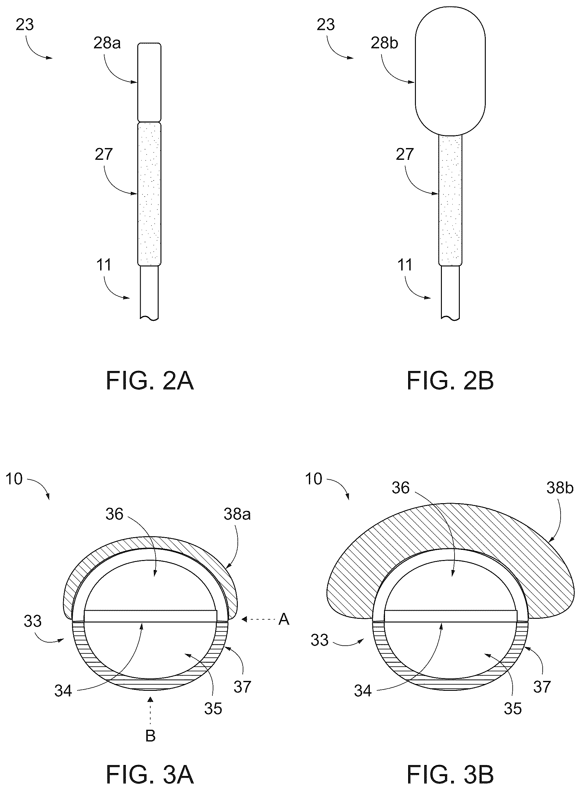 Patent US12496385 Figure 3 – Peritoneal dialysis catheter with an expandable structure
