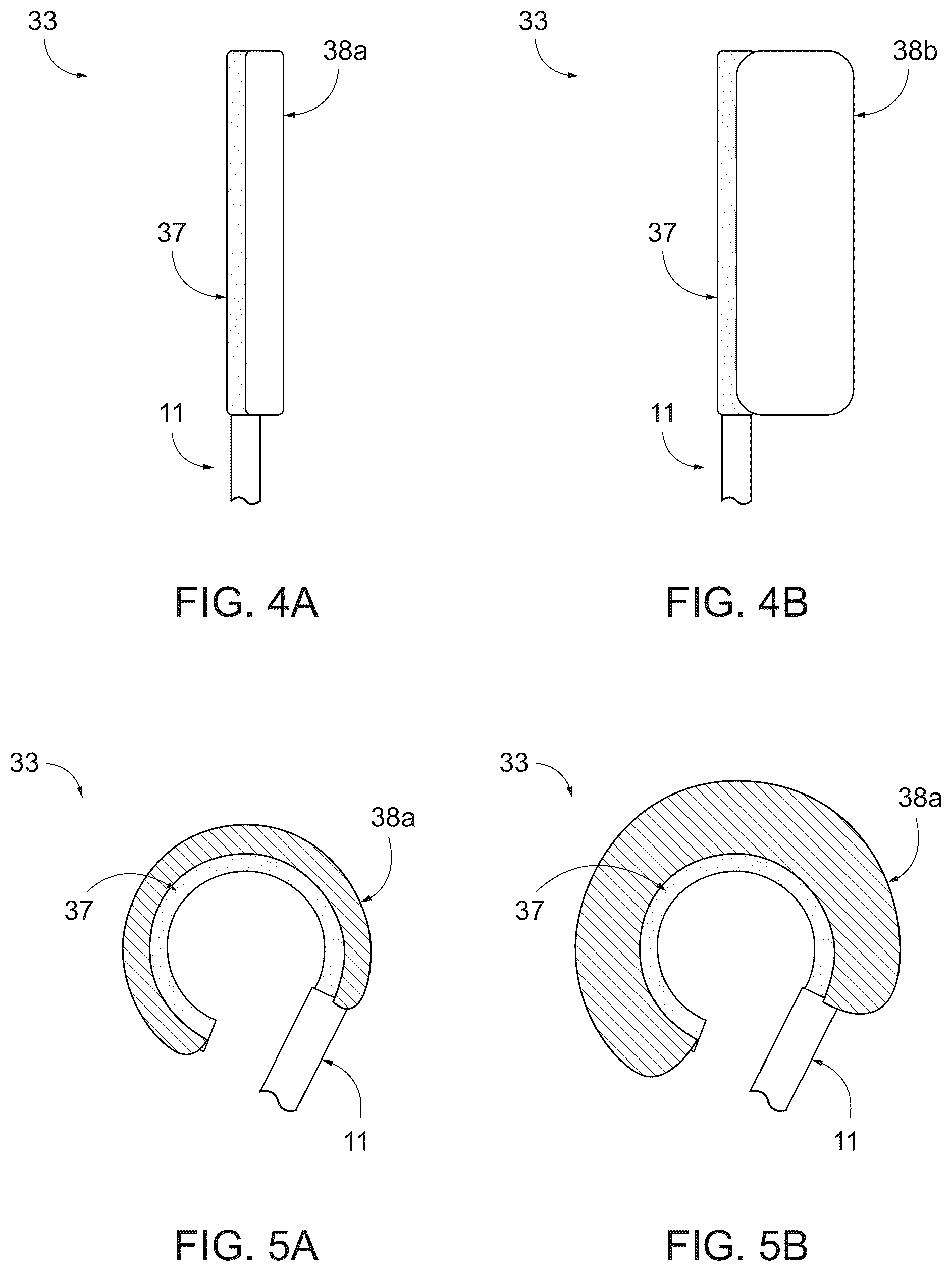 Patent US12496385 Figure 4 – Peritoneal dialysis catheter with an expandable structure