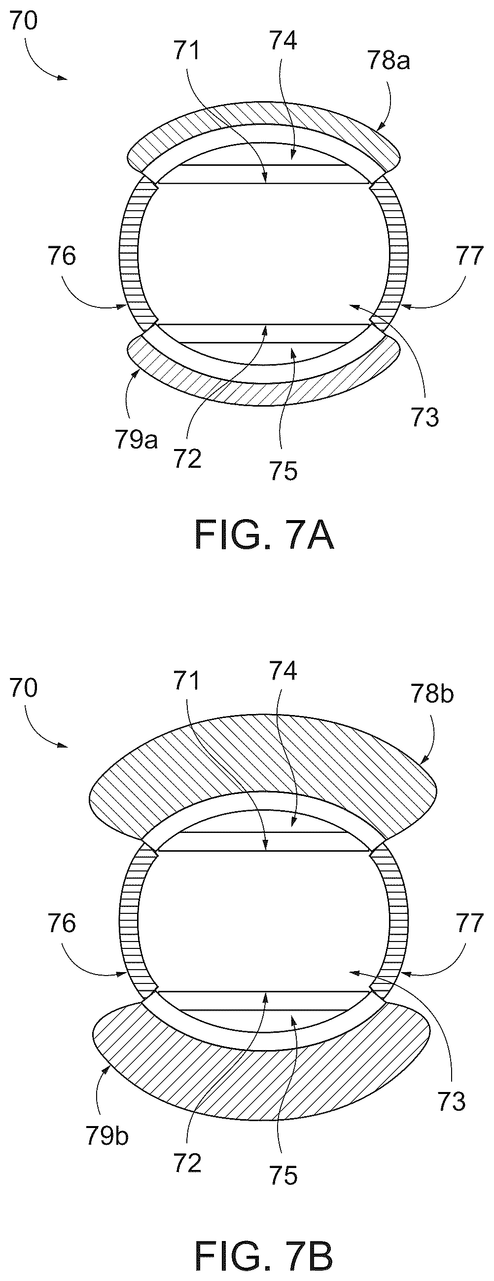 Patent US12496385 Figure 6 – Peritoneal dialysis catheter with an expandable structure