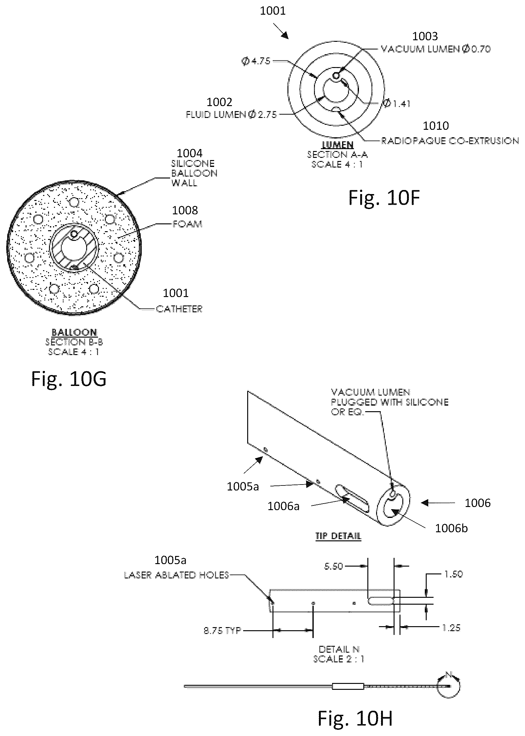 Patent US12496385 Figure 11 – Peritoneal dialysis catheter with an expandable structure