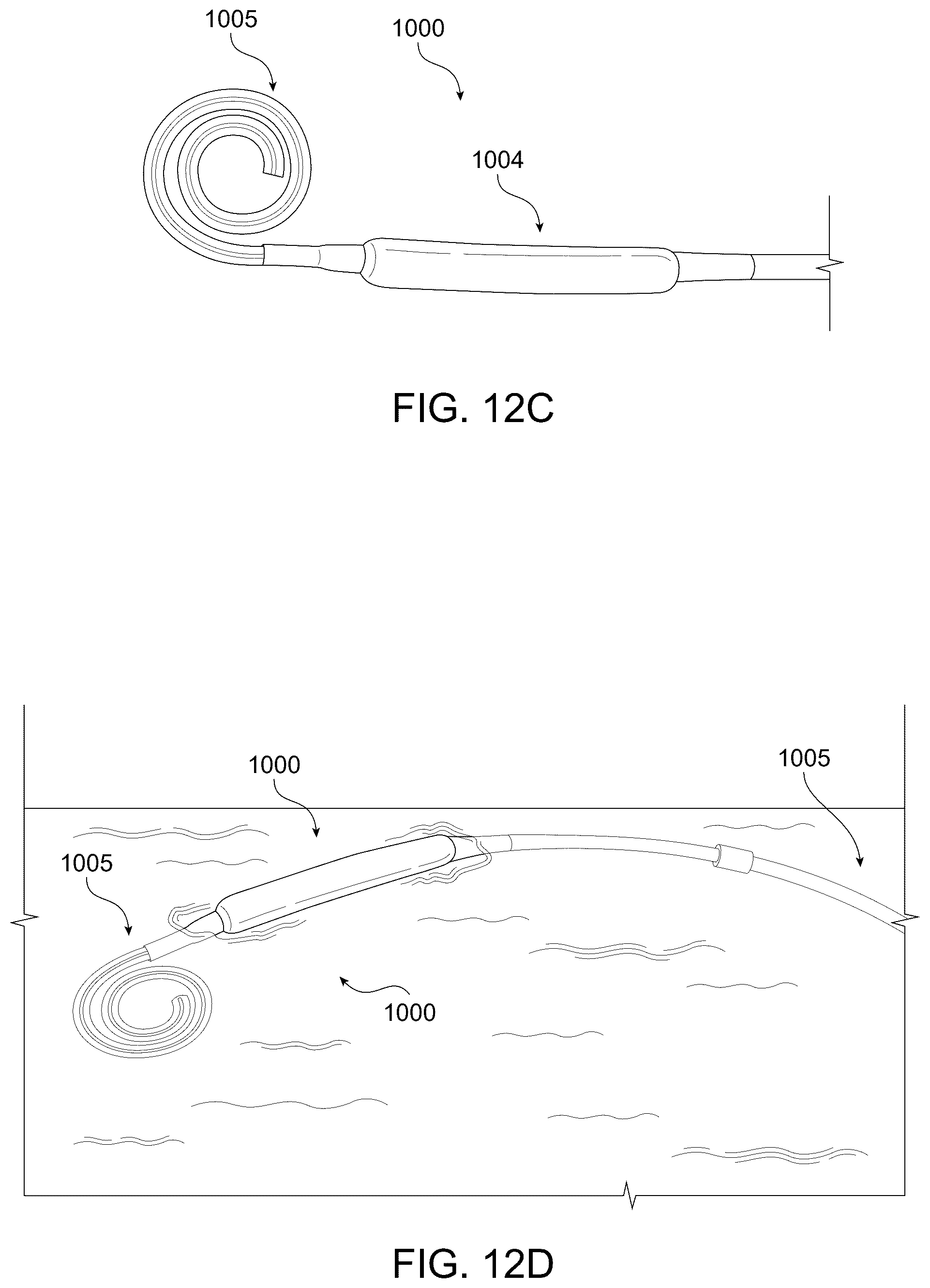 Patent US12496385 Figure 17 – Peritoneal dialysis catheter with an expandable structure