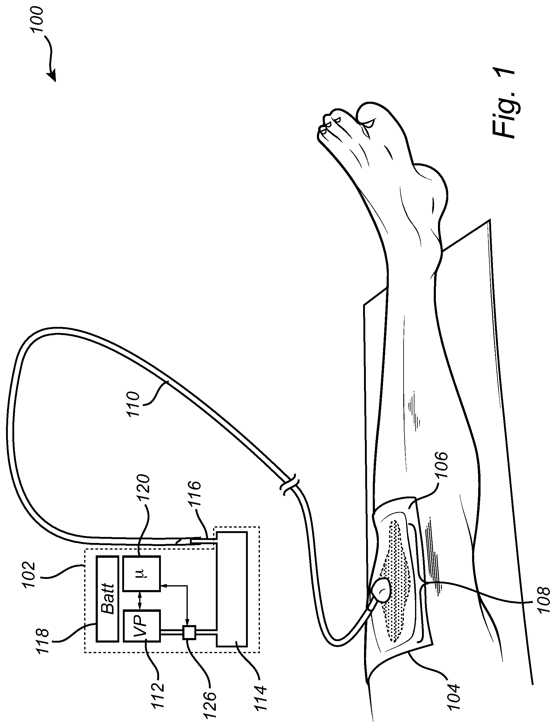 Patent US12496391 Figure 1 – Mobile negative pressure wound therapy device