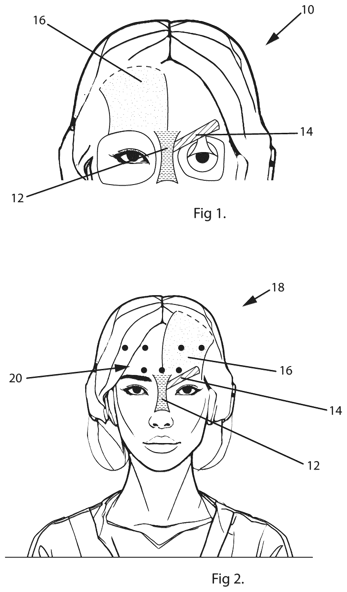 Patent US12496392 Figure 1 – Method of providing a personal drug injection system