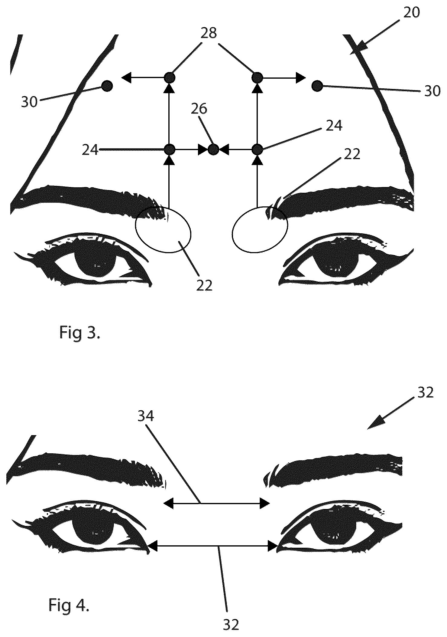 Patent US12496392 Figure 2 – Method of providing a personal drug injection system
