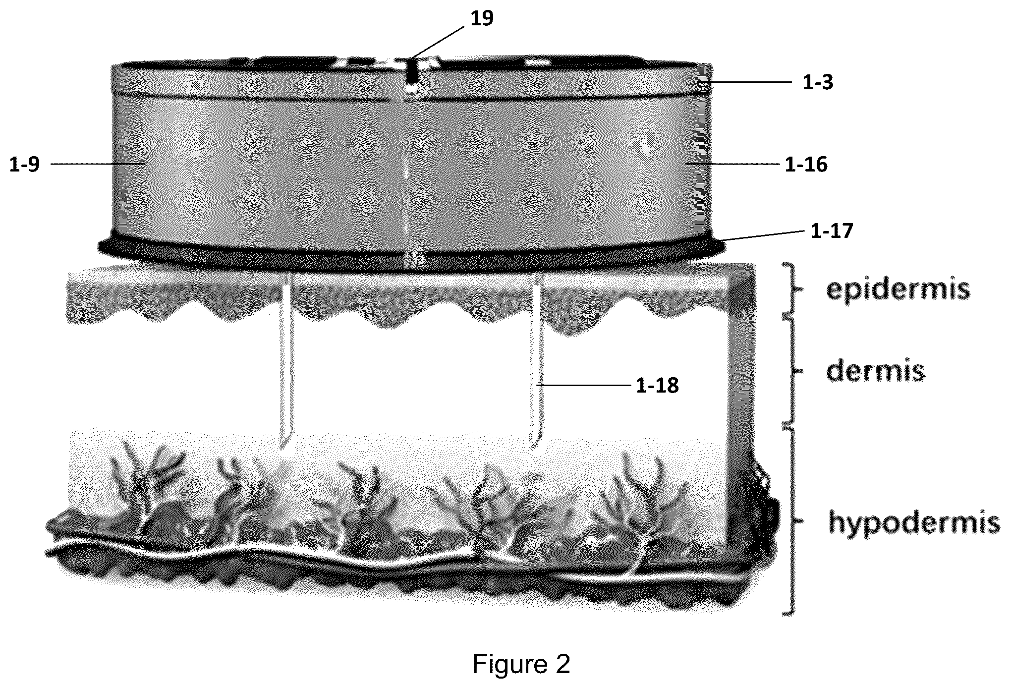 Patent US12496393 Figure 2 – Ultra-miniaturized wireless-controlled patch type drug pump and its preparation method