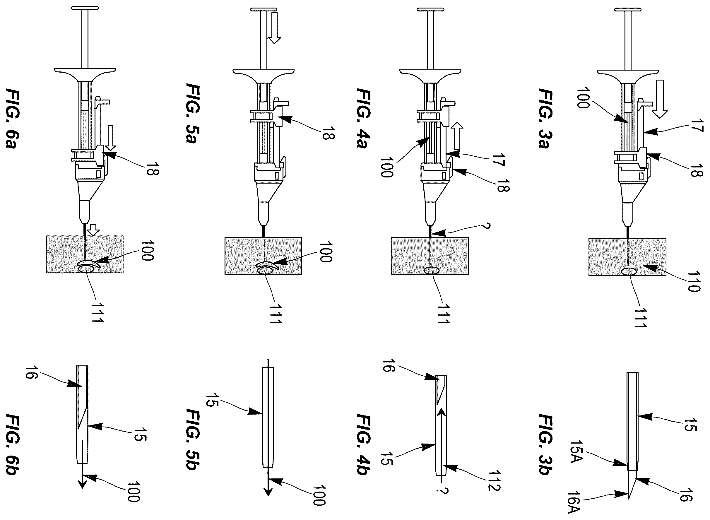 Patent US12496409 Figure 2 – Injection head for injecting a fluid substance and permitting monitoring of the injection site before injection of the fluid substance, and syringe comprising such a head