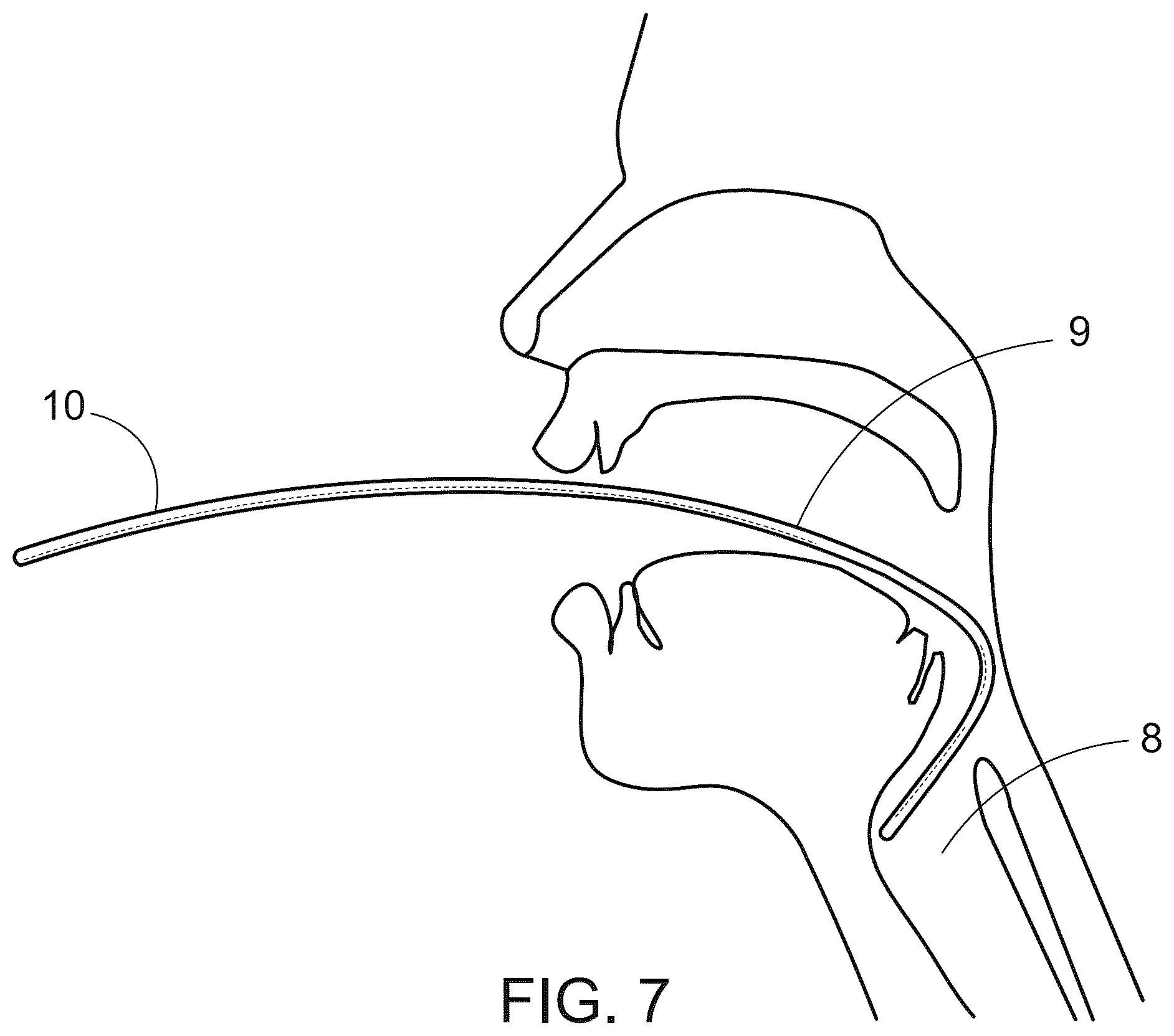 Patent US12496416 Figure 7 – Tracheal introducer sheath